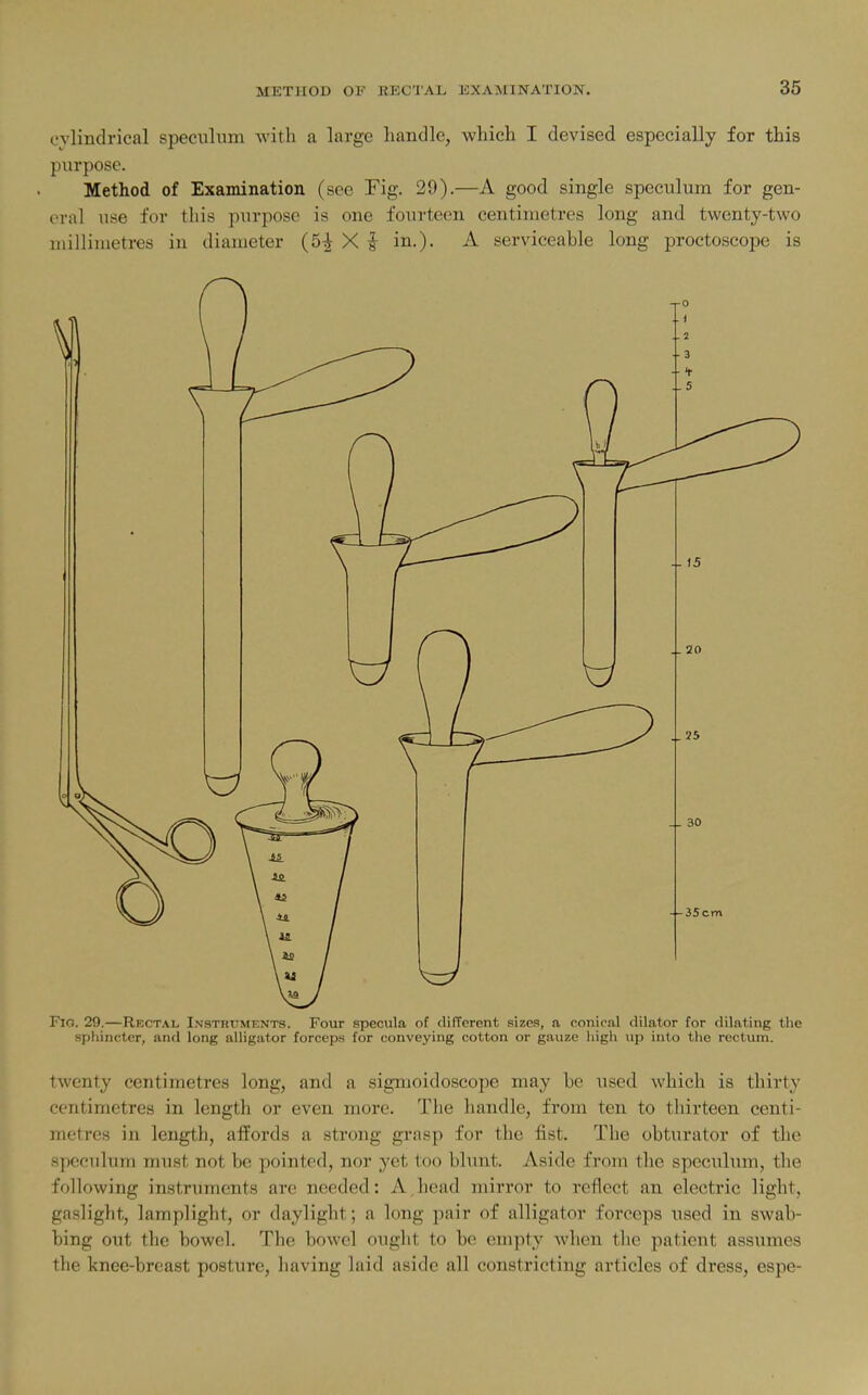 cylindrical speculum with a large liandle, which I devised especially for this purpose. Method of Examination (see Fig. 29).—A good single speculum for gen- oral use for this purpose is one fourteen centimetres long and twenty-two iiiilliinetres in diameter (5| X i in.). A serviceable long proctoscope is Fia. 29.—Rectal Insthuments. Four specula of different sizes, n conical dilator for dilating the sphincter, and long alligator forceps for conveying cotton or gauze high up into tiie rectum. twenty centimetres long, and a sigmoidoscope may be used which is thirty centimetres in length or even more. The handle, from ten to thirteen centi- metres in length, affords a strong grasp for the fist. The obturator of the speculum must not be pointed, nor yet too bhmt. Aside from the speculum, the following instruments are needed: A head mirror to reflect an electric light, gaslight, lamplight, or daylight; a long pair of alligator forceps used in swab- bing out the bowel. The bowel ought to be em]ity when the patient assumes the knee-breast posture, having laid aside all constricting articles of dress, espe-