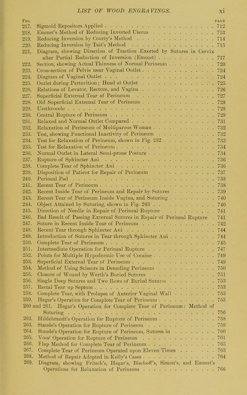FlO. PAGB 217. Sigmoid Repositors Applied 712 218. Emmet's Method of Reducing Inverted Uterus 713 219. Reducing Inversion by Courty's Method 714 220. Reducing Inversion by Tail's Method 715 221. Diagram, showing Direction of Traction Exerted by Sutures In Cervix after Partial Reduction of Inversion (Emmet) 717 222. Section, showing Actual Thinness of Normal Perineum 720 223. Cross-section of Pelvis near Vaginal Outlet 724 224. Diagram of Vaginal Outlet 724 225. Outlet during Parturition ; Head at Outlet 725 226. Relations of Levator, Rectum, and Vagina 726 227. Superficial External Tear of Perineum 727 228. Old Superficial External Tear of Perineum 728 229. Urethrocele 728 230. Central Rupture of Perineum 729 231. Relaxed and Normal Outlet Com[)ared 731 232. Relaxation of Perineum of Multiparous Woman 732 233. Test, showing Functional Inactivity of Perineum 732 234. Test for Relaxation of Perineum, shown in Fig. 232 733 235. Test for Relaxation of Perineum 734 236. Normal Outlet in Lateral Semi-prone Posture 734 237. Rupture of Sphincter Ani 736 238. Complete Tear of Sphincter Ani 736 239. Disposition of Patient for Repair of Perineum 737 240. Perineal Pad 738 241. Recent Tear of Perineum 738 242. Recent Inside Tear of Perineum and Repair by Sutures 739 243. Recent Tear of Perineum Inside Vagina, and Suturing 740 244. Object Attained by Suturing, shown in Fig. 243 740 245. Direction of Needle in Repair of Perineal Rupture 741 246. Bad Result of Passing External Sutures in Repair of Perineal Rupture • 741 247. Suture in Recent Inside Tear of Perineum 742 248. Recent Tear through Sphincter Ani 744 249. Introduction of Sutures in Tear through Sphincter Ani 744 250. Complete Tear of Perineum 745 251. Intermediate Operation for Perineal Rupture 747 252. Points for Multiple Hypodermic Use of Cocaine 749 253. Superficial E.xternal Tear of Perineum 749 254. Method of Using Scissors in Denuding Perineum 750 255. Closure of Woimd by Werth's Buried Sutures 751 256. Single Deep Sutures and Two Rows of Buried Sutures 753 257. Rectal Tear up Septmn 753 258. Complete Tear, with Prolapse of Anterior Vaginal Wall 753 259. Hegar's Operation for Complete Tear of Perineum 755 260 and 2G1. Hegar's Operation for Complete Tear of Perineum: Method of Suturing 7156 262. Hildcbrandt's Operation for Rupture of Perineum 758 263. Staude's Operation for Rupture of I'crineiuu 759 264. Staude's Operation for Rupture of Perineum, Sutures in 760 265. Voos' Operation for Rupture of Perineum 761 266. Flap Method for Com[)lete Tear of Perineum 763 267. Complete Tear of Perineum Operated upon Eleven Times 763 268. Method of Repair Adopted in Kelly's Cases 764 269. Diagram, showing Fritscli's, HeKar's, BischofT's, Simon's, and Emmet's Operations for Relaxation of Perineum 766
