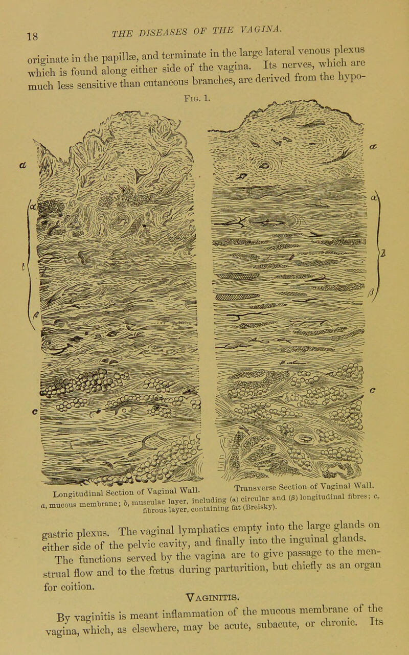 oric^inate in the papilla, and terminate in the large lateral venous plexus W Long ei'ther side of the vagina. Its —e, .^^^^^^^^^^^ much less sensitive than cutaneous branches, are derived fiom the h>po Fig. 1. - -~ . , ,ir„ii Transverse Section of Vaginal Wall. ' fibrous layer, containing tat iiircisKj gastric plexus. The vaginal lymphatics empty into the large glands on Ser sfde of the pelvic cavity, and finally into the mguina g ands. The functions Served by the vagina are to give passage to the men- strual flow and to the fcBtus during parturition, but chiefly as an organ for coition. Vaginitis. By vaginitis is meant inflammation of the mucous membrane of the vagina, which, as elsewhere, may be acute, subacute, or chronic. Its