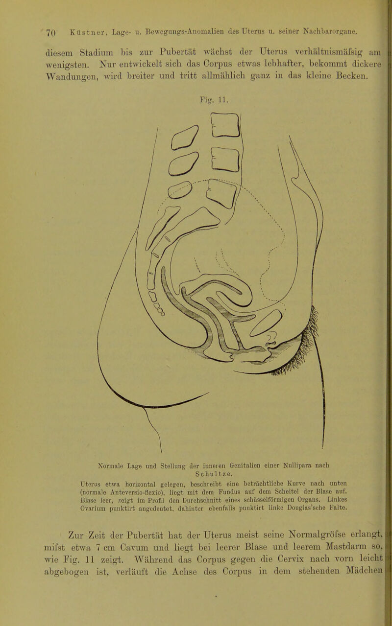 diesem Stadium bis zur Pubertät wächst der Uterus verhältnismäfsig am wenigsten. Nur entwickelt sich das Corpus etwas lebhafter, bekommt dickere Wandungen, wird breiter und tritt allmählich ganz in das kleine Becken. Fig. 11. Normale Lage und Stellung der inneren Genitalien einer Nullipara nach S c h u 11 z e. Uterus etwa horizontal gelegen, beschreibt eine beträchtliche Kurve nach unten (normale Anteversio-Ilexio), liegt mit dem Fundus auf dem Scheitel der Blase auf. Blase leer, zeigt im Profil den Durchschnitt eines schüsselförmigen Organs. Linkes Ovarium punktirt augedeutet, dahinter ebenfalls punktirt linke Douglas’sche Falte. Zur Zeit der Pubertät hat der Uterus meist seine Normalgröfse erlangt, mifst etwa 7 cm Cavum und liegt bei leerer Blase und leerem Mastdarm so, wie Fig. 11 zeigt. Während das Corpus gegen die Cervix nach vorn leicht abgebogen ist, verläuft die Achse des Corpus in dem stehenden Mädchen