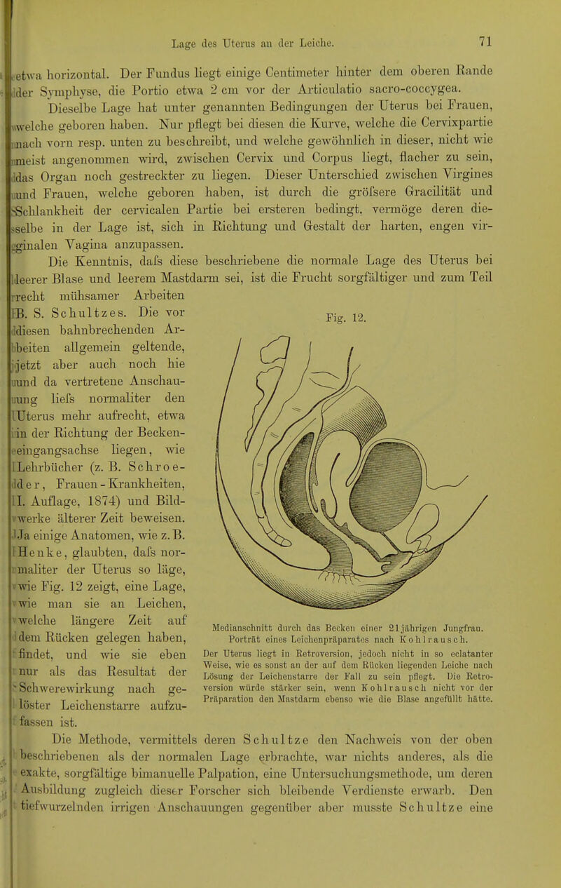 Lage des Uterus an der Leiche. Fig. 12. eetwa horizontal. Der Fundus liegt einige Centimeter hinter clem oberen Rande der Symphyse, die Portio etwa 2 cm vor der Articulatio sacro-coccygea. Dieselbe Lage hat unter genannten Bedingungen der Uterus bei Frauen, welche geboren haben. Nur pflegt bei diesen die Kurve, welche die Cervixpartie nach vorn resp. unten zu beschreibt, und welche gewöhnlich in dieser, nicht wie meist angenommen wird, zwischen Cervix und Corpus liegt, flacher zu sein, das Organ noch gestreckter zu liegen. Dieser Unterschied zwischen Virgines und Frauen, welche geboren haben, ist durch die gröfsere Gracilität und 'Schlankheit der cervicalen Partie bei ersteren bedingt, vermöge deren die- selbe in der Lage ist, sich in Richtung und Gestalt der harten, engen vir- ginalen Vagina anzupassen. Die Kenntnis, dafs diese beschriebene die normale Lage des Uterus bei 1 deerer Blase und leerem Mastdarm sei, ist die Frucht sorgfältiger und zum Teil recht mühsamer Arbeiten 1B. S. Schultzes. Die vor diesen bahnbrechenden Ar- beiten allgemein geltende, jetzt aber auch noch hie uund da vertretene Anschau- uun g liefs normaliter den lUterus mehr aufrecht, etwa in der Richtung der Becken- eingangsachse liegen, wie Lehrbücher (z. B. Schroe- d e r , Frauen - Krankheiten, I. Auflage, 1874) und Bild- werke älterer Zeit beweisen. 1 Ja einige Anatomen, wie z. B. Henke, glaubten, dafs nor- maliter der Uterus so läge, wie Fig. 12 zeigt, eine Lage, wie man sie an Leichen, welche längere Zeit auf dem Rücken gelegen haben, findet, und wie sie eben ; nur als das Resultat der 'Schwerewirkung nach ge- ! löster Leichenstarre aufzu- Medianschnitt durch das Becken einer 21jährigen Jungfrau. Porträt eines Leichenpräparates nach Kohl rausch. Der Uterus liegt in Retroversion, jedoch nicht in so eclatanter Weise, wie es sonst an der auf dem Rücken liegenden Leiche nach Lösung der Leichenstarre der Fall zu sein pflegt. Die Retro- version würde stärker sein, wenn Kohl rausch nicht vor der Präparation den Mastdarm ebenso wie die Blase angefüllt hätte. I fassen ist. Die Methode, vermittels deren Schultze den Nachweis von der oben 1 beschriebenen als der normalen Lage erbrachte, war nichts anderes, als die j exakte, sorgfältige bimanuelle Palpation, eine Untersuchungsmethode, um deren ! Ausbildung zugleich dieser Forscher sich bleibende Verdienste erwarb. Den tiefwurzelnden irrigen Anschauungen gegenüber aber musste Schultze eine