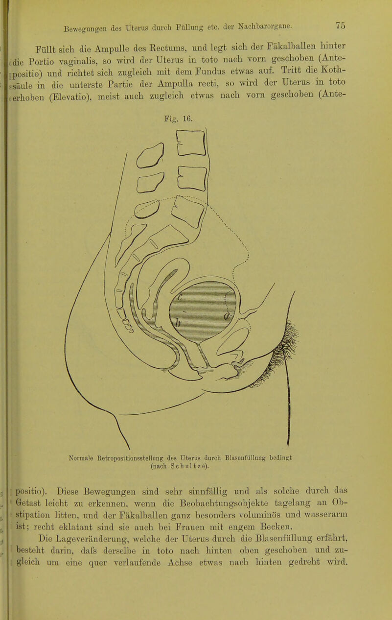 Bewegungen des Uterus durch Füllung etc. der Nachbarorgane. Füllt sich die Ampulle des Rectums, und legt sich der Fäkalballen hinter die Portio vaginalis, so wird der Uterus in toto nach vorn geschoben (Ante- , positio) und richtet sich zugleich mit dem Fundus etwas auf. Tritt die Koth- ,säule in die unterste Partie der Ampulla recti, so wird der Uterus in toto erhoben (Elevatio), meist auch zugleich etwas nach vorn geschoben (Ante- Kormale Retropositiorisstelhing des Uterus durch Blaseufiillung bedingt (nach Schultze). Fig. 16. positio). Diese Bewegungen sind sehr sinnfällig und als solche durch das Betast leicht zu erkennen, wenn die Beobachtungsobjekte tagelang an Ob- stipation litten, und der Fäkalballen ganz besonders voluminös und wasserarm ist; recht eklatant sind sie auch bei Frauen mit engem Becken. Die Lageveränderung, welche der Uterus durch die Blasenfüllung erfährt, besteht darin, dafs derselbe in toto nach hinten oben geschoben und zu- gleich um eine quer verlaufende Achse etwas nach hinten gedreht wird.