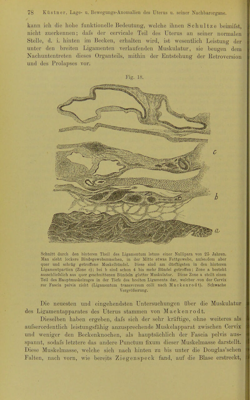 kann ich die hohe funktionelle Bedeutung, welche ihnen Scliultze beimifst, nicht zuerkennen; dafs der cervicale Teil des Uterus an seiner normalen Stelle, d. i. hinten im Becken, erhalten wird, ist wesentlich Leistung der unter den breiten Ligamenten verlaufenden Muskulatur, sie beugen dem Nachuntentreten dieses Organteils, mithin der Entstehung der Betroversion und des Prolapses vor. Fig. 18. Schnitt durch den hinteren Theil des Ligamentum latum einer Nullipara von 25 Jahren. Man sieht lockere Bindegewebsmaschen, in der Mitte etwas Fettgewebe, aufsei dom aber quer und schräg getroffene Muskelbündel. Diese sind am dürftigsten in den hinteren Ligamentpartien (Zone c); bei b sind schon 4 bis mehr Bündel getroffen; Zone a besteht ausschliefslich aus quer geschnittenen Bündeln glatter Muskulatur. Diese Zone a stellt einen Teil des Hauptmuskelzuges in der Tiefe des breiten Ligaments dar, welcher von der Cervix zur Fascia pelvis zieht (Ligamentum transversum colli nach Mackenrodt). Schwache Vergröfserung. Die neuesten und eingehendsten Untersuchungen über die Muskulatur des Ligamentapparates des Uterus stammen von Mackenrodt. Dieselben haben ergeben, dafs sich der sehr kräftige, ohne weiteres als aufserordentlich leistungsfähig anzusprechende Muskelapparat zwischen Cervix und weniger den Beckenknochen, als hauptsächlich der Fascia pelvis aus- spannt, sodafs letztere das andere Punctum fixurn dieser Muskelmasse darstellt. Diese Muskelmasse, welche sielt nach hinten zu bis unter die Douglas’schen | Falten, nach vorn, wie bereits Ziegen speck fand, auf die Blase erstreckt, I