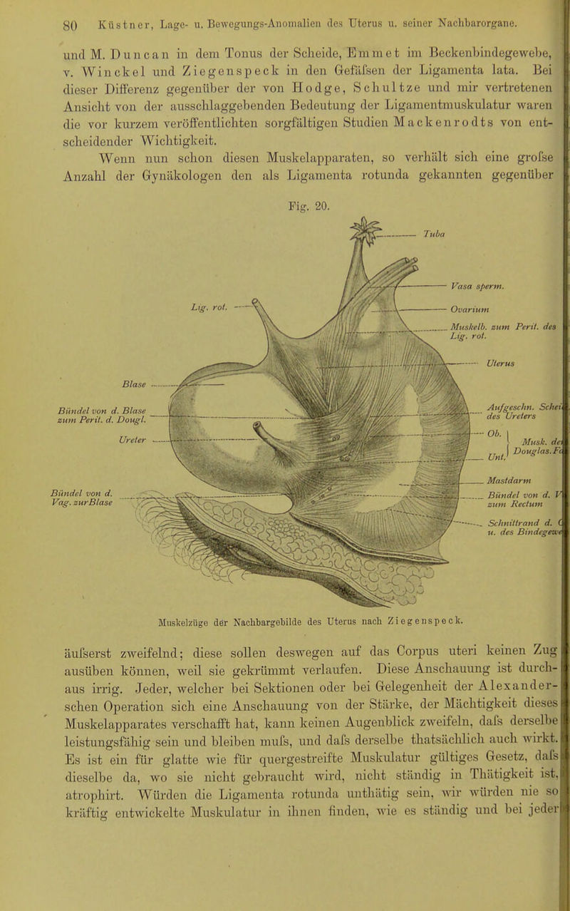 und M. Duncan in dem Tonus der Scheide, Eminet im Beckenbindegewebe, v. Win ekel und Ziegenspeck in den Gefäfsen der Ligamenta lata. Bei dieser Differenz gegenüber der von Hodge, Schultze und mir vertretenen Ansicht von der ausschlaggebenden Bedeutung der Ligamentmuskulatur waren die vor kurzem veröffentlichten sorgfältigen Studien Mackenrodts von ent- scheidender Wichtigkeit. Wenn nun schon diesen Muskelapparaten, so verhält sich eine grofse Anzahl der Gynäkologen den als Ligamenta rotunda gekannten gegenüber Fig. 20. Tuba Vasa sperm. Ovarium Muskelb. zum Perü. des Lig. rot. Uterus Bündel von d. Blase zum Pcrit. d. üougl. Ureter Aufgeschn. Scheu des Ureters Unt: Musk. dc\ Douglas. Fc Mastdarm Bündel von d. V zum Rectum Schnittrand d. C u. des Bindegewc Blase —. Bündel von d. Vag. zur Blase Muskelzüge der Nachbargebilde des Uterus nach Ziegenspeck. äufserst zweifelnd; diese sollen deswegen auf das Corpus uteri keinen Zug I ausüben können, weil sie gekrümmt verlaufen. Diese Anschauung ist durch-11 aus irrig. Jeder, welcher bei Sektionen oder bei Gelegenheit der Al exander-1 sehen Operation sich eine Anschauung von der Stärke, der Mächtigkeit dieses! Muskelapparates verschafft hat, kann keinen Augenblick zweifeln, dafs derselbe! leistungsfähig sein und bleiben mufs, und dafs derselbe tliatsäclilich auch wirkt.! Es ist ein für glatte wie für quergestreifte Muskulatur gültiges Gesetz, dafs! dieselbe da, wo sie nicht gebraucht wird, nicht ständig in Thätigkeit ist.! atrophirt. Würden die Ligamenta rotunda unthätig sein, wir würden nie so» kräftig entwickelte Muskulatur in ihnen finden, wie es ständig und bei jederB