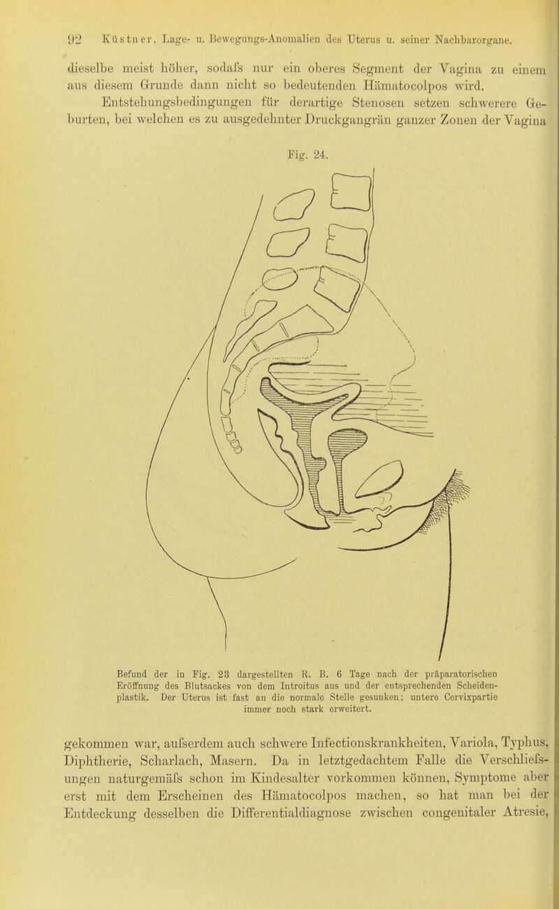 Befund der in Fig. 23 dargestellten R. B. 6 Tage nach der präparatorischen Eröffnung des Blutsackes von dem Introitus aus und der entsprechenden Scheiden- plastik. Der Uterus ist fast an die normale Stelle gesunken; untere Cervixpartie immer noch stark erweitert. gekommen war, aufserdem auch schwere Infectionskrankheiten, Variola, Typhus, Diphtherie, Scharlach, Masern. Da in letztgedachtem Falle die Verschliefs- ungen naturgemäfs schon im Kindesalter Vorkommen können, Symptome aber erst mit dem Erscheinen des Hämatocolpos machen, so hat man bei der Entdeckung desselben die Differentialdiagnose zwischen congenitaler Atresie, 92 Küstn er, Lage- u. Bewegungs-Anomalien des Uterus u. seiner Nachbarorgane. dieselbe meist höher, sodafs nur ein oberes Segment der Vagina zu einem aus diesem Grunde dann nicht so bedeutenden Hämatocolpos wird. Entstehungsbedingungen für derartige Stenosen setzen schwerere Ge- burten, bei welchen es zu ausgedehnter Druckgangrän ganzer Zonen der Vagina Fig. 24.