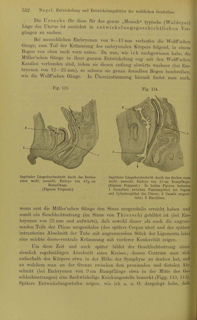 r.to OO-j Nagel, Entwickelung und Entwickelungsfehler der weiblichen Genitalien. Die Ursache für diese für das genus „Mensch“ typische (Wald Lage des Uterus ist zunächst iu entwickelungsgeschichtlichen gangen zu suchen. eyer) Vor- Bei menschlichen Embryonen von 8—13 mm verlaufen die Wolffsehen Gänge, zum Teil der Krümmung des embryonalen Körpers folgend, in einem Bogen von oben nach vorn unten. Da nun, wie ich nachgewiesen habe, die Müller’schen Gänge in ihrer ganzen Entwickelung eng mit den WolfFschen Kanälen verbunden sind, indem sie diesen entlang abwärts wachsen (bei Em- bryonen von 12—25 mm), so müssen sie genau denselben Bogen beschreiben, wie die Wolff sehen Gänge. In Übereinstimmung hiermit findet man auch, Fig. 113. Fig. 114. Sagittaler Längsdurchschnitt durch das Becken eines weibl. ineuschl. Embryo von 41/2 ein Rumpflänge. (Eigenes Präparat.) Sagittaler Längsdurchschnitt durch das Becken eines weibl. nienschl. Embryo von 10 cm Rumpflänge. (Eigenes Präparat.) In beiden Figuren bodeuten 1 Grenzlinie zwischen Plattenepithel der Vagina und Cylinderepithel des Uterus; 2 Caualis urogeni- talis; 3 Harnblase. wenn erst die Müller’schen Gänge den Sinus urogenitalis erreicht haben und somit ein Geschlechtsstrang (im Sinne von Thier sch) gebildet ist (bei Em- bryonen von 25 nun und aufwärts), dafs sowohl dieser als auch die angren- zenden Teile der Plicae urogenitales (das spätere Corpus uteri und der spätere intrauterine Abschnitt der Tube mit angrenzendem Stück der Ligamenta lata) eine seichte dorso-ventrale Krümmung mit vorderer Konkavität zeigen. Um diese Zeit und auch später bildet der Geschlechtsstrang einen ziemlich regelmäfsigen Abschnitt eines Kreises, dessen Centrum man sich aufserhalb des Körpers etwa in der Höhe der Symphyse zu denken hat, und an welchem man an der Grenze zwischen dem proximalen und distalen Ab- schnitt (bei Embryonen von 9 cm Rumpflänge etwa in der Mitte des Ge- schlechtsstranges) eine flachwinkelige Knickungsstelle bemerkt (Figg. 113, 114). Spätere Entwickelungsstufen zeigen, wie ich a. a. 0. dargelegt habe, dafs