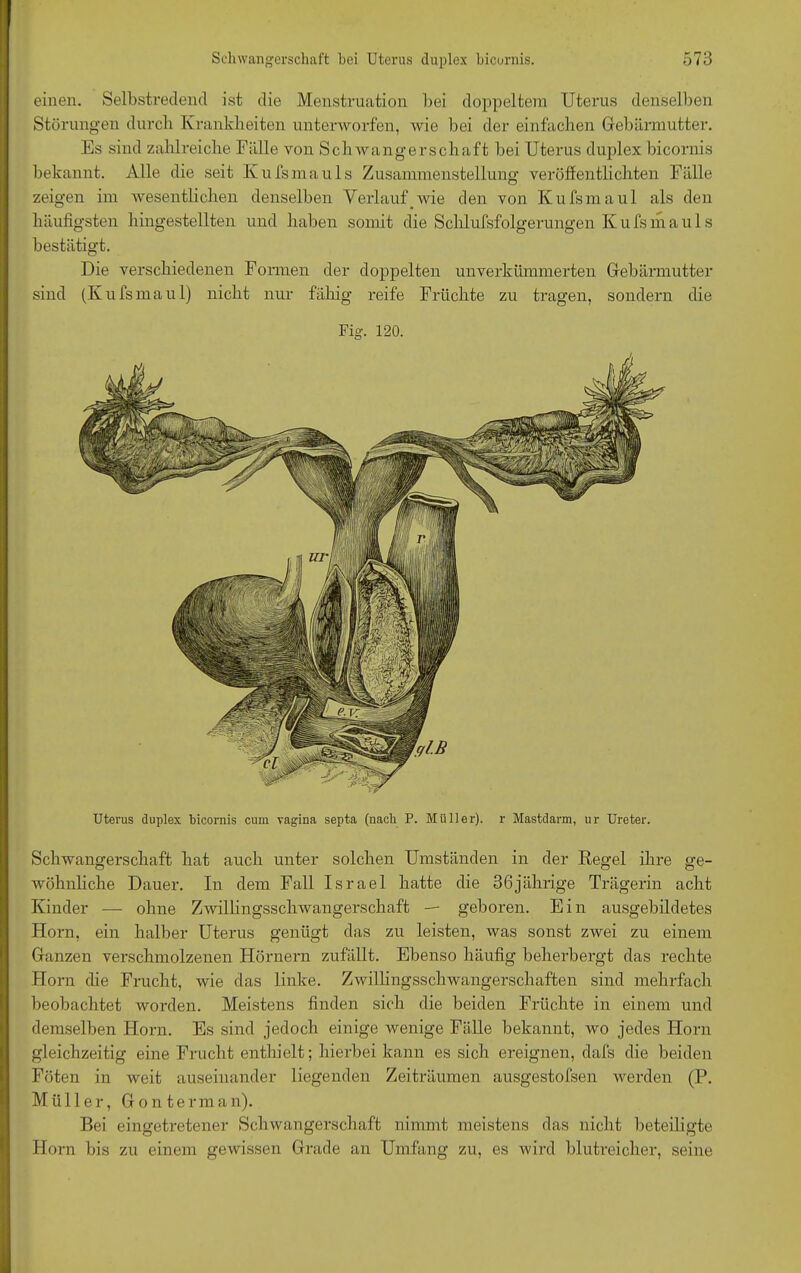 einen. Selbstredend ist die Menstruation bei doppeltem Uterus denselben Störungen durch Krankheiten unterworfen, wie bei der einfachen Gebärmutter. Es sind zahlreiche Fälle von Schwangerschaft bei Uterus duplex bicornis bekannt. Alle die seit Kufsmauls Zusammenstellung veröffentlichten Fälle zeigen im wesentlichen denselben Verlauf wie den von Kufsmaul als den häufigsten hingestellten und haben somit die Schlufsfolgerungen K u fs in a u 1 s bestätigt. Die verschiedenen Formen der doppelten unverkümmerten Gebärmutter sind (Kufsmaul) nicht nur fällig reife Früchte zu tragen, sondern die Fig. 120. Uterus duplex bicornis cum vagina septa (nach P. Müller), r Mastdarm, ur Ureter. Schwangerschaft hat auch unter solchen Umständen in der Regel ihre ge- wöhnliche Dauer. In dem Fall Israel hatte die 36jährige Trägerin acht Kinder — ohne Zwillingsschwangerschaft — geboren. Ein ausgebildetes Horn, ein halber Uterus genügt das zu leisten, was sonst zwei zu einem Ganzen verschmolzenen Hörnern zufällt. Ebenso häufig beherbergt das rechte Horn die Frucht, wie das linke. Zwillingsschwangerschaften sind mehrfach beobachtet worden. Meistens finden sich die beiden Früchte in einem und demselben Horn. Es sind jedoch einige wenige Fälle bekannt, wo jedes Horn gleichzeitig eine Frucht enthielt; hierbei kann es sich ereignen, dafs die beiden Föten in weit auseinander liegenden Zeiträumen ausgestofsen werden (P. Müller, Gonterman). Bei eingetretener Schwangerschaft nimmt meistens das nicht beteiligte Horn bis zu einem gewissen Grade an Umfang zu, es wird blutreicher, seine