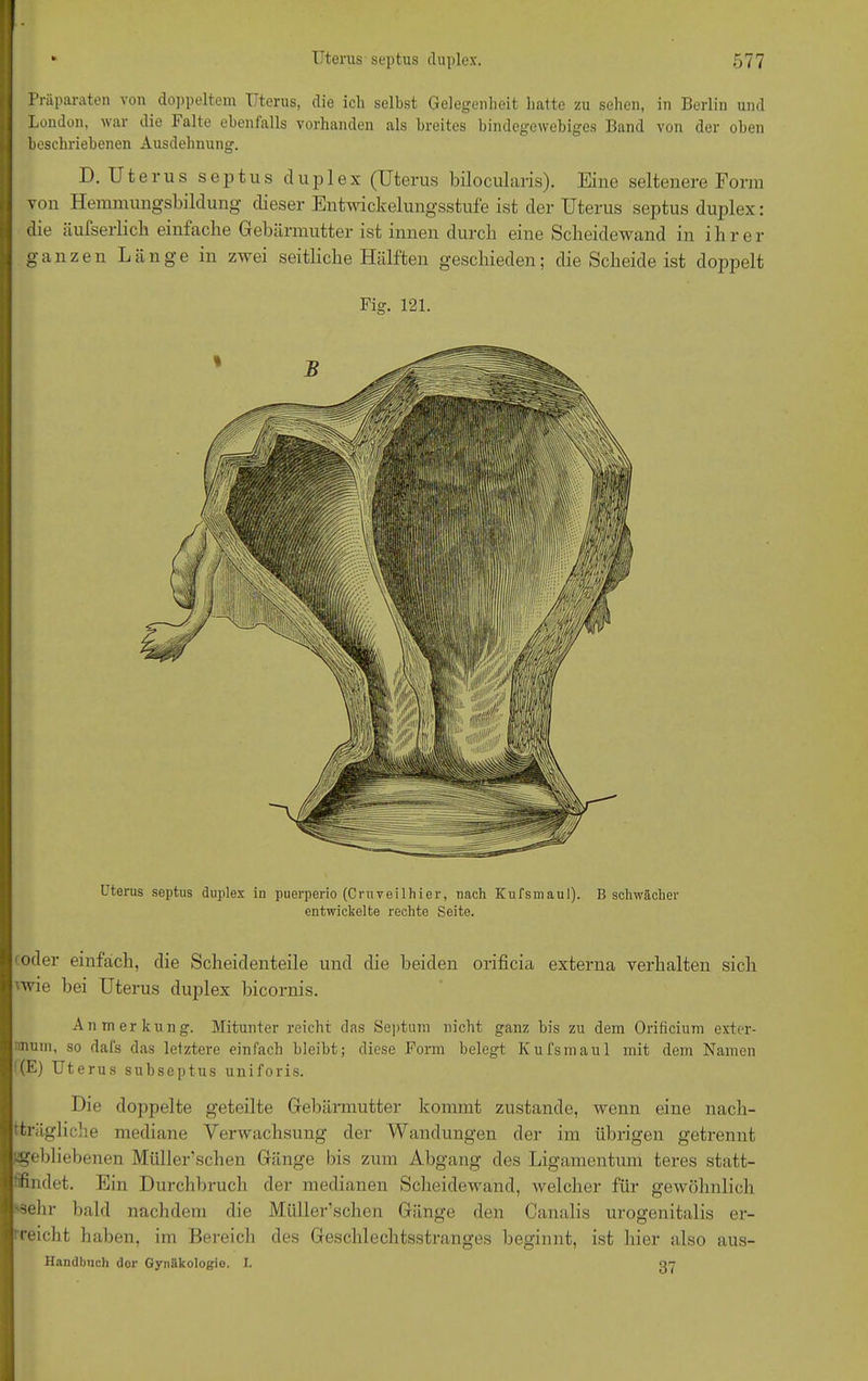 Präparaten von doppeltem Uterus, die ich selbst Gelegenheit hatte zu sehen, in Berlin und London, war die Falte ebenfalls vorhanden als breites bindegewebiges Band von der oben beschriebenen Ausdehnung. D. Uterus septus duplex (Uterus bilocularis). Eine seltenere Form von Hemmungsbildung dieser Entwickelungsstufe ist der Uterus septus duplex: die äufserlich einfache Gebärmutter ist innen durch eine Scheidewand in ihre r ganzen Länge in zwei seitliche Hälften geschieden; die Scheide ist doppelt Fig. 121. Uterus septus duplex in puerperio (Cruveilhier, nach Kufsmaul). B schwächer entwickelte rechte Seite. oder einfach, die Scheidenteile und die beiden orificia externa verhalten sich 'wie bei Uterus duplex bicornis. Anmerkung. Mitunter reicht das Septum nicht ganz bis zu dem Orificium exter- nnurn, so dafs das letztere einfach bleibt; diese Form belegt Kufsmaul mit dem Namen (E) Uterus subseptus uniforis. Die doppelte geteilte Gebärmutter kommt zustande, wenn eine nach- tträgliche mediane Verwachsung der Wandungen der im übrigen getrennt «gebliebenen Müller’schen Gänge bis zum Abgang des Ligamentum teres statt- tifindet. Ein Durchbruch der medianen Scheidewand, welcher für gewöhnlich 'Sehr bald nachdem die Müller’schen Gänge den Canalis urogenitalis er- ^ reicht haben, im Bereich des Geschlechtsstranges beginnt, ist liier also aus- Handbuch dor Gynäkologie. I. 07