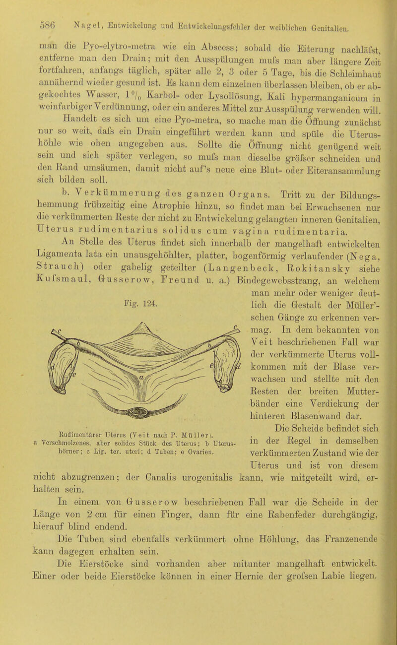 man die Pyo-elytro-metra wie ein Abscess; sobald die Eiterung nachläfst, entferne man den Drain; mit den Ausspülungen mufs man aber längere Zeit foi tfaln en, anfangs täglich, später alle 2, .j oder 5 Tage, bis die Schleimhaut annähernd wieder gesund ist. Es kann dem einzelnen überlassen bleiben, ob er ab- gekochtes Wasser, 1 °/0 Karbol- oder Lysollösung, Kali hypermanganicum in 'weint<u Ingei Vei dünnung, oder ein anderes Mittel zur Ausspülung' verwenden will. Handelt es sich um eine Pyo-metra, so mache man die Öffnung zunächst nur so weit, dafs ein Drain eingeführt werden kann und spüle die Uterus- höhle wie oben angegeben aus. Sollte die Öffnung nicht genügend weit sein und sich später verlegen, so mufs man dieselbe gröfser schneiden und den Rand umsäumen, damit nicht auf’s neue eine Blut- oder Eiteransammlung sich bilden soll. b. Verkümmerung des ganzen Organs. Tritt zu der Bildungs- hemmung fi ühzeitig eine Atrophie hinzu, so findet man bei Erwachsenen nur die verkümmerten Reste der nicht zu Entwickelung gelangten inneren Genitalien, Uterus rud imentarius solidus cum vagina rudimentaria. An Stelle des Uterus findet sich innerhalb der mangelhaft entwickelten Ligamenta lata ein unausgehöhlter, platter, bogenförmig verlaufender (N eg a, Strauch) oder gabelig geteilter (Langenbeck, Rokitansky siehe Kufsmau 1, Gusserow, Freund u. a.) Bindegewebsstrang, an welchem man mehr oder weniger deut- Vig. 124. lieh die Gestalt der Müller’- schen Gänge zu erkennen ver- mag. In dem bekannten von Veit beschriebenen Fall war der verkümmerte Uterus voll- kommen mit der Blase ver- wachsen und stellte mit den Resten der breiten Mutter- bänder eine Verdickung der hinteren Blasenwand dar. Die Scheide befindet sich in der Regel in demselben verkümmerten Zustand wie der Uterus und ist von diesem Budimentärer Uterus (Veit nach P. Müllerl. a Verschmolzenes, aber solides Stück des Uterus; b Uterus- hörner; c Lig. ter. uteri; d Tuben; e Ovarien. nicht abzugrenzen der Canalis urogenitalis kann, wie mitgeteilt wird, er- halten sein. In einem von Gusserow beschriebenen Fall war die Scheide in der Länge von 2 cm für einen Finger, dann für eine Rabenfeder durchgängig, hierauf blind endend. Die Tuben sind ebenfalls verkümmert ohne Höhlung, das Franzenende kann dagegen erhalten sein. Die Eierstöcke sind vorhanden aber mitunter mangelhaft entwickelt. Einer oder beide Eierstöcke können in einer Hernie der grofsen Labie liegen.