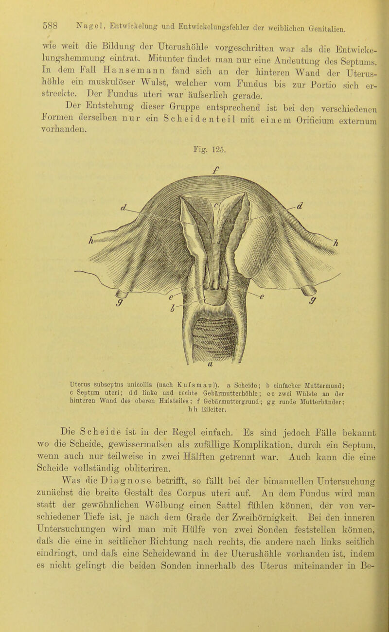 wie weit die Bildung der Uterushöhle vorgeschritten war als die Entwicke- ln ngshemin ung eintrat. Mitunter findet man nur eine Andeutung des Septums. In dem Fall Hansemann fand sich an der hinteren Wand der Uterus- höhle ein muskulöser Wulst, welcher vom Fundus bis zur Portio sich er- streckte. Der Fundus uteri war äufserlich gerade. Der Entstehung dieser Gruppe entsprechend ist bei den verschiedenen Foimen dei selben nur ein Sch eidenteil mit einem Orificium externum vorhanden. Fig. 125. £ Uterus subseptus unicollis (nach Kufsmaul), a Scheide; b einfacher Muttermund; c Septum uteri; dd linke und rechte Gebärmutterhöhle; ee zwei Wülste au der hinteren Wand des oberen Halsteiles; f Gebärmuttergrund; gg runde Mutterbänder; h h Eileiter. Die Scheide ist in der Kegel einfach. Es sind jedoch Fälle bekannt wo die Scheide, gewissermafsen als zufällige Komplikation, durch ein Septum, wenn auch nur teilweise in zwei Hälften getrennt war. Auch kann die eine ' Scheide vollständig obliteriren. Was die Diagnose betrifft, so fällt bei der bimanueUen Untersuchung zunächst die breite Gestalt des Corpus uteri auf. An dem Fundus wird man statt der gewöhnlichen Wölbung einen Sattel fühlen können, der von ver- schiedener Tiefe ist, je nach dem Grade der Zweihörnigkeit. Bei den inneren Untersuchungen wird man mit Hülfe von zwei Sonden feststellen können, dafs die eine in seitlicher Richtung nach rechts, die andere nach links seitlich eindringt, und dafs eine Scheidewand in der Uterushöhle vorhanden ist, indem es nicht gelingt die beiden Sonden innerhalb des Uterus miteinander in Be- f