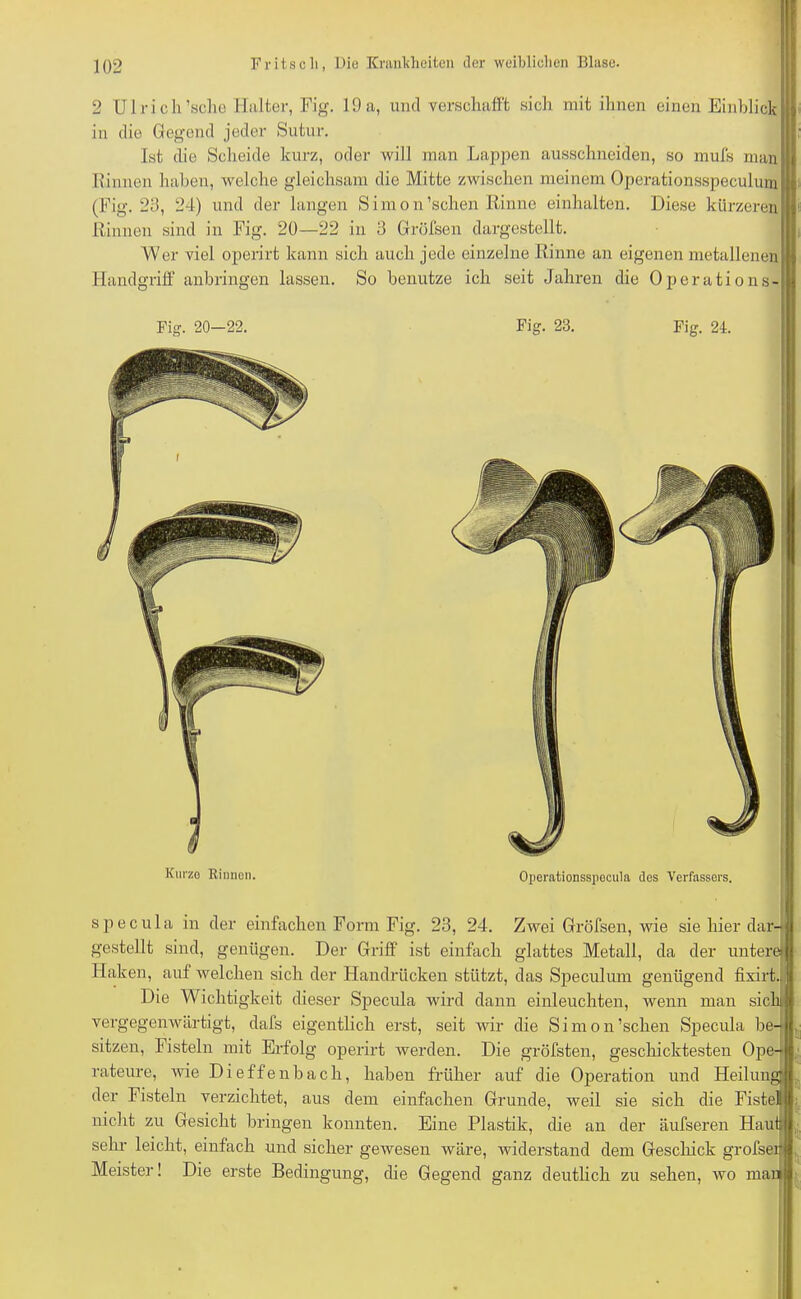 2 Ul rieh'sehe Halter, Fig. 19 a, uncl verschafft sich mit ihnen einen Einblick in die Gegend jeder Sutur. Ist die Scheide kurz, oder will man Lappen ausschneidcn, so mufs mal Rinnen haben, welche gleichsam die Mitte zwischen meinem Operationsspeculum (Fig. 23, 24) und der langen Simon'sehen Rinne einhalten. Diese kürzeren Rinnen sind in Fig. 20—22 in 3 Gröfsen dargestellt. Wer viel operirt kann sich auch jede einzelne Rinne an eigenen metallenen Handgriff anbringen lassen. So benutze ich seit Jahren die Operations- Fig. 20—22. Fig. 23. Fig. 21. Kurze Rinnen. Operationsspecula dos Verfassers. specula in der einfachen Form Fig. 23, 24. Zwei Gröfsen, wie sie hier dar- gestellt sind, genügen. Der Griff ist einfach glattes Metall, da der untere! Haken, auf welchen sich der Handrücken stützt, das Speculum genügend fixirt.. Die Wichtigkeit dieser Specula wird dann einleuchten, wenn man sich vergegenwärtigt, dafs eigentlich erst, seit wir die Simon'sehen Specula be- sitzen, Fisteln mit Erfolg operirt werden. Die gröfsten, geschicktesten Ope- rateure, wie Dieffenbach, haben früher auf die Operation und Heilung der Fisteln verzichtet, aus dem einfachen Grunde, weil sie sich die Fistelt nicht zu Gesicht bringen konnten. Eine Plastik, die an der äufseren Haufe sehr leicht, einfach und sicher gewesen wäre, widerstand dem Geschick grofser Meister! Die erste Bedingung, die Gegend ganz deutlich zu sehen, wo mau