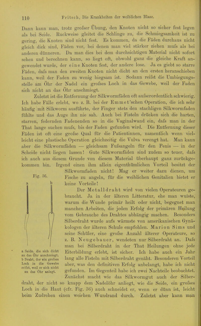 Dann kann man, trotz grofser Übung, den Knoten nicht so sicher fest legen als bei Seide. Ruckweise gleitet die Schlinge zu, die Schmiegsamkeit ist zu o-erin»\ die Knoten sind nicht fest. Es kommen, da die Fäden durchaus nicht gleich dick sind, Fäden vor, bei denen man viel stärker ziehen mufs als bei anderen dünneren. Da man dies bei dem durchsichtigen Material nicht sofort sehen und berechnen kann, so liegt oft, obwohl ganz die gleiche Kraft an- gewendet wurde, der eine Knoten fest, der andere lose. Ja es giebt so starre Fäden, dal's man den zweiten Knoten nicht dicht an den ersten heranschieben kann, weil der Faden zu wenig biegsam ist. Sodann reifst die Umbiegungs- stelle am Öhr der Nadel ein grofses Loch in das Gewebe, weil der Faden sich nicht an das Öhr anschmiegt. Zuletzt ist die Entfernung der Silkwormfäden oft aufserordentlich schwierig. Ich habe Fälle erlebt, wo z. B. bei der Emmet’schen Operation, die ich sehl- häufig mit Silkworm ausführte, der Finger stets den stachligen Silkwormfäden fühlte und das Auge ihn nie sah. Auch bei Fisteln drücken sich die harten, starren, federnden Fadenenden so in die Vaginalwand ein, dafs man in der That lange suchen mufs, bis der Faden gefunden wird. Die Entfernung dieser Fäden ist oft eine grofse Qual für die Patientinnen, namentlich wenn viel- leicht eine plastische Operation gleichzeitig die Vulva verengt hat. Man kann aber die Silkwormfäden — gleichsam Fufsangeln für den Penis — in der Scheide nicht liegen lassen! Gute Silkwormfäden sind zudem so teuer, dafs ich auch aus diesem Grunde von diesem Material überhaupt ganz zurückge- kommen bin. Irgend einen ihm allein eigentümlichen Vorteil besitzt der Silkwormfäden nicht! Mag er weiter dazu dienen, um Fische zu angeln, für die weiblichen Genitalien bietet er keine Vorteile! Der Met all dr ah t wird von vielen Operateuren ge- braucht. Ja in der älteren Litteratur, ehe man wulste, warum die Wunde primär heilt oder nicht, begegnet man manchen Arbeiten, die jeden Erfolg der primären Heilung vom Gebrauche des Drahtes abhängig machen. Besonders Silberdraht wurde aufs wärmste von amerikanischen Gynä- kologen der älteren Schule empfohlen. Marion Sims und seine Schüler, eine grofse Anzahl älterer Operateure, so z. B. Neugebauer, wendeten nur Silberdraht an. Dafs man bei Silberdraht in der That Heilungen ohne jede Eiterbildung erlebt, ist sicher. Ich habe auch ein Jahr lang alle Fisteln mit Silberdraht genäht. Besonderen Vorteil aber, was den definitiven Erfolg anbelangt, habe ich nicht gefunden. Im Gegenteil habe ich zwei Nachteile beobachtet. Zunächst macht wie das Silkwormgut auch der Silber- draht, der nicht so knapp dem Nadelöhr anliegt, wie die Seide, ein grofses Loch in die Haut (cfr. Fig. 36) auch schneidet er, wenn er dünn ist, leicht beim Zudrehen einen weichen Wundrand durch. Zuletzt aber kann man Fig. 36. a Seide, die sich dicht an das Öhr anschmiegt. h Draht, der ein grofses Loch in die Gewebe reifst, weil er sich nicht an das Öhr anlegt.
