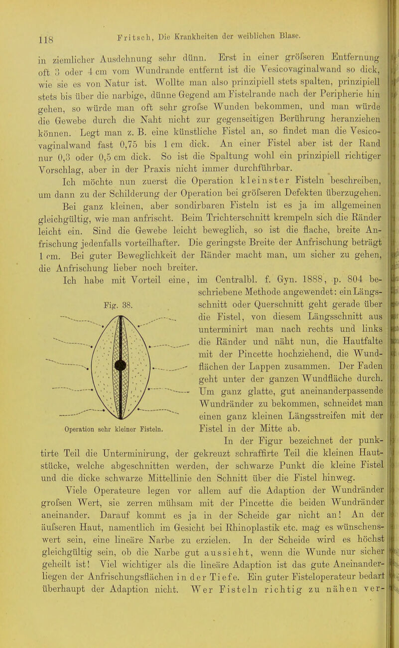in ziemlicher Ausdehnung sehr dünn. Erst in einer grölseren Entfernung oft 3 oder 4 cm vom Wundrande entfernt ist die Yesicovaginalwand so dick, wie sie es von Natur ist. Wollte man also prinzipiell stets spalten, prinzipiell stets bis über die narbige, dünne Gregend am Fistelrande nach der Peripherie hin o-ehen, so würde man oft sehr grofse Wunden bekommen, und man würde die Gewebe durch die Naht nicht zur gegenseitigen Berührung heranziehen können. Legt man z. B. eine künstliche Fistel an, so findet man die Vesico- vasinalwand fast 0,75 bis 1 cm dick. An einer Fistel aber ist der Rand nur 0,3 oder 0,5 cm dick. So ist die Spaltung wohl ein prinzipiell richtiger Vorschlag, aber in der Praxis nicht immer durchführbar. Ich möchte nun zuerst die Operation kleinster Fisteln beschreiben, um dann zu der Schilderung der Operation bei gröfseren Defekten überzugehen. Bei ganz kleinen, aber sondirbaren Fisteln ist es ja im allgemeinen gleichgültig, wie man anfrischt. Beim Trichterschnitt krempeln sich die Ränder leicht ein. Sind die Gewebe leicht beweglich, so ist die flache, breite An- frischung jedenfalls vorteilhafter. Die geringste Breite der Anfrischung beträgt 1 cm. Bei guter Beweglichkeit der Ränder macht man, um sicher zu gehen, die Anfrischung lieber noch breiter. Ich habe mit Vorteil eine, im Centralbl. f. Gyn. 1888, p. 804 be- schriebene Methode angewendet: ein Längs- schnitt oder Querschnitt geht gerade über die Fistel, von diesem Längsschnitt aus unterminirt man nach rechts und links die Ränder und näht nun, die Hautfalte mit der Pincette hochziehend, die Wund- flächen der Lappen zusammen. Der Faden geht unter der ganzen Wundfläche durch. Um ganz glatte, gut aneinanderpassende Wundränder zu bekommen, schneidet man einen ganz kleinen Längsstreifen mit der Fistel in der Mitte ab. In der Figur bezeichnet der punk- tirte Teil die Unterminirung, der gekreuzt schraffirte Teil die kleinen Haut- stiicke, welche abgeschnitten werden, der schwarze Punkt die kleine Fistel und die dicke schwarze Mittellinie den Schnitt über die Fistel hinweg. Viele Operateure legen vor allem auf die Adaption der Wundränder grofsen Wert, sie zerren mühsam mit der Pincette die beiden Wundränder aneinander. Darauf kommt es ja in der Scheide gar nicht an! An der äufseren Haut, namentlich im Gesicht bei Rhinoplastik etc. mag es wünschens- wert sein, eine lineäre Narbe zu erzielen. In der Scheide wird es höchst gleichgültig sein, ob die Narbe gut aussieht, wenn die Wunde nur sicher geheilt ist! Viel wichtiger als die lineäre Adaption ist das gute Aneinander- liegen der Anfrischungsflächen in der Tiefe. Ein guter Fisteloperateur bedarf überhaupt der Adaption nicht. Wer Fisteln richtig zu nähen ver- Fi£. 38. ; !