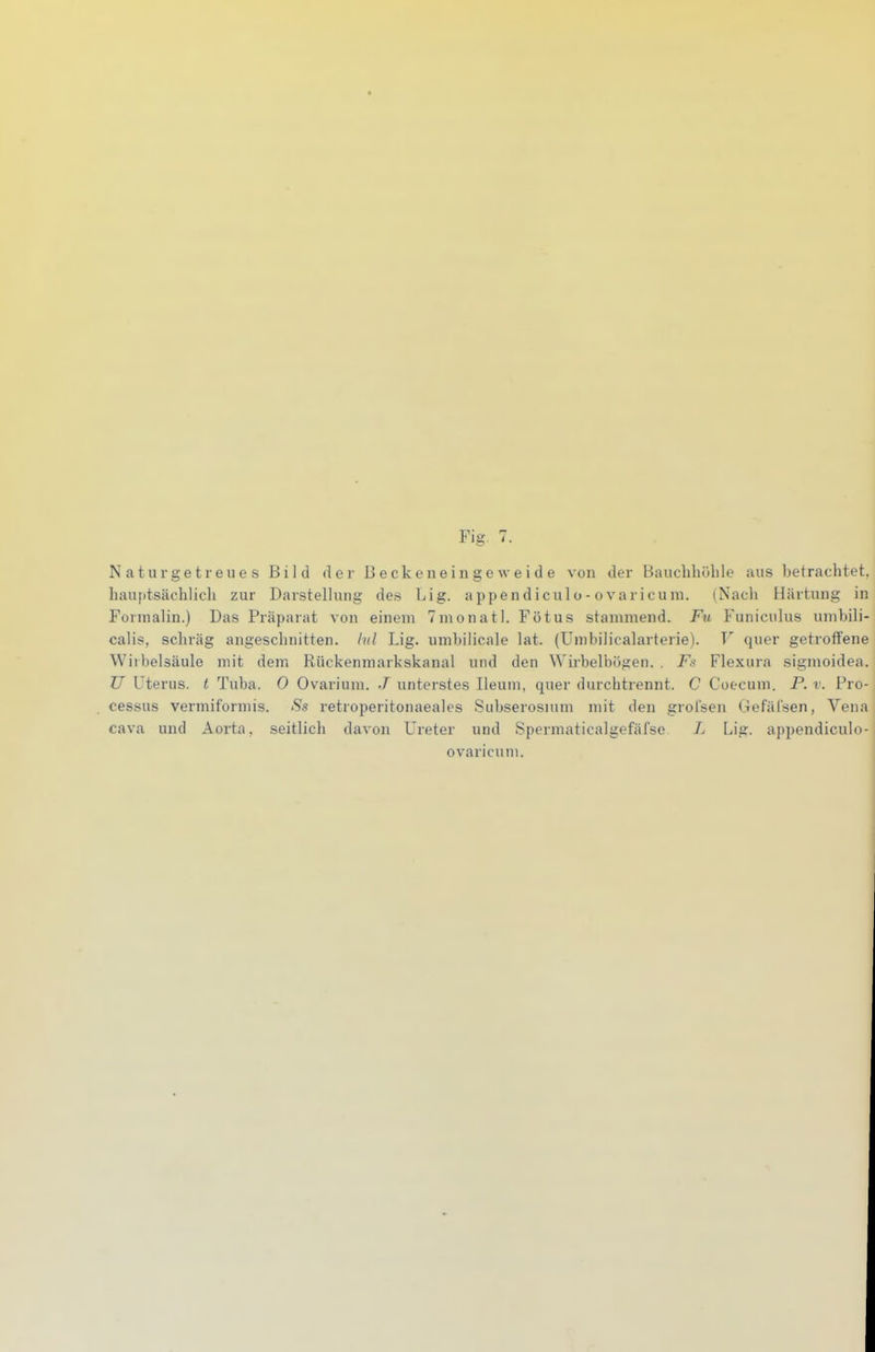 « Fig. 7. Naturgetreues Bild der Becken ei ngeweide von der Bauchliühle aus betrachtet, hauf)tsächlicli zur Darstellung des Lig. appendiculo-ovaricura, (Nach Härtung in Formalin.) Das Präparat von einem Tmonatl. Fötus stammend. Fu Funiculus umbili- calis, schräg angesclmitten. /«/ Lig. umbilicale lat. (Umbilicalarterie). T'' quer getroflfene Wirbelsäule mit dem Rückenmarkskanal und den Wirbelbögen. , Fs Flexura sigmoidea. TJ Uterus, t Tuba. 0 Ovarium. ./ unterstes Ileum, quer durchtrennt. C Coecum. P. v. Pro- cessus vermiformis. Ss retroperitonaeales Subserosium mit den grolsen Gefäl'sen, Vena Cava und Aorta, seitlich davon Ureter und Spermaticalgefäfse L Lig. appendiculo- ovaricum.