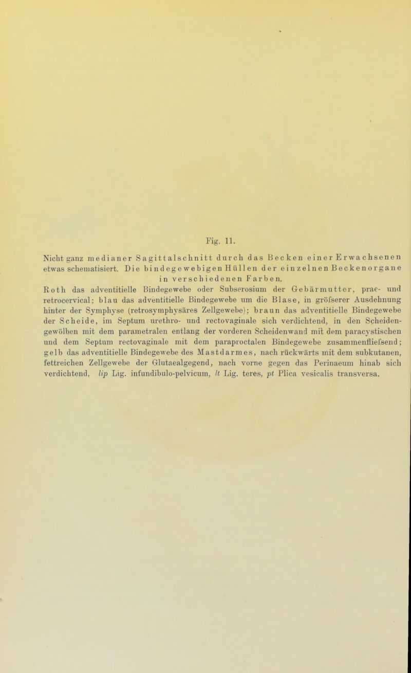 Fig. 11. Nicht ganz medianer Sagittalschnitt durch das Becken einer Erwachsenen etwas schematisiert. Die bindegewebigen Hüllen der einzelnen Beckenorgane in verschiedenen Farben. Roth das adventitielle Bindegewebe oder Subserosium der Gebärmutter, prae- nnd retrocervical; blau das adventitielle Bindegewebe um die Blase, in gröi'serer Ausdehnung hinter der Symphyse (retrosymphysäres Zellgewehe): braun das adventitielle Bindegewebe der Scheide, im Septum urethi'o- und i-ectovaginale sich verdichtend, in den Scheiden- gewölben mit dem parametralen entlang der vorderen Scheidenwand mit dem paracystischen und dem Septum rectovaginale mit dem paraproctalen Bindegewebe zusammenfliefsend; gelb das adventitielle Bindegewebe des Mastdarmes, nach rückwärts mit dem subkutanen, fettreichen Zellgewebe der Glutaealgegend, nach vorne gegen das Perinaeum hinab sich verdichtend, Up Lig. infundibulo-pelvicum, It Lig. teres, pt Plica vesicalis transversa.