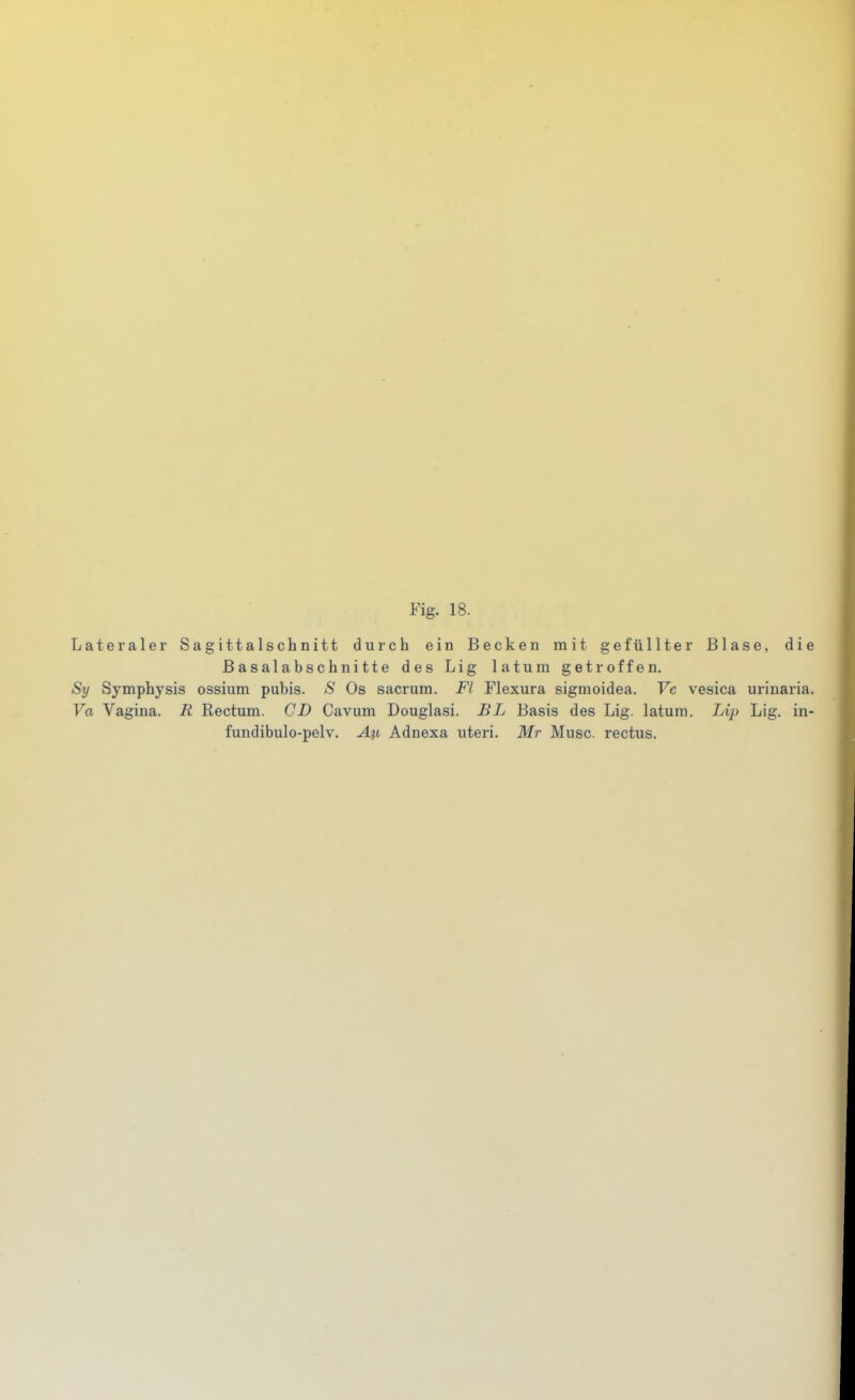 Lateraler Sagittalschnitt durch ein Becken mit gefüllter Blase, die ßasalabschnitte des Lig latum getroffen. Sy Symphysis ossium pubis. S Os sacrum. Fl Flexura sigmoidea. Ve vesica urinaria. Va Vagina. R Rectum. CD Cavum Douglasi. £L Basis des Lig. latum. Lip Lig. in- fundibulo-pelv. Axt Adnexa uteri. Mr Muse, rectus.