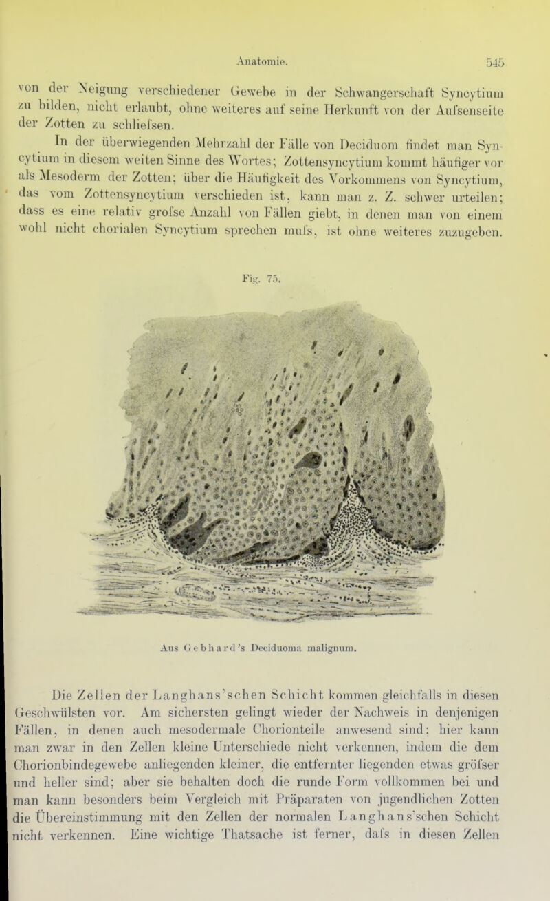 von der Neigung verscliiedener Gewebe in der Schwangerschaft Syncytiuiu zu bilden, nicht erhmbt, ohne weiteres auf seine Herkunft von der Aufsenseite der Zotten zu schliefsen. In der überwiegenden Mehrzahl der Fälle von Deciduom findet man Syn- cytium in diesem weiten Sinne des Wortes; Zottensyncytium kommt häutiger vor als Mesoderm der Zotten; über die Häutigkeit des Vorkommens von Syncytium, das vom Zottensyncytium verschieden ist, kann man z. Z. schwer urteilen; dass es eine relativ groi'se Anzahl von Fällen giebt, in denen man von einem wohl nicht chorialen Syncytium sprechen mufs, ist ohne weiteres zuzugeben. Fig. 7ö. Aus Gebhard's Deciduoniii maligniim. Die Zellen der Langhans'sehen Schicht kommen gleichfalls in diesen (lesclnvülsten vor. Am sichersten gelingt wieder der Nachweis in denjenigen I^'ällen, in denen auch mesodermale Chorionteile anwesend sind; hier kann man zwar in den Zellen kleine Unterschiede nicht verkennen, indem die dem Chorionbindegewebe anliegenden kleiner, die entfernter liegenden etwas gröfser und heller sind; aber sie behalten doch die runde Form vollkommen bei und man kann besonders beim Vergleich mit Präparaten von jugendlichen Zotten die Übereinstimmung mit den Zellen der normalen Langhans'schen Schicht nicht verkennen. Eine wichtige Thatsache ist ferner, dafs in diesen Zellen