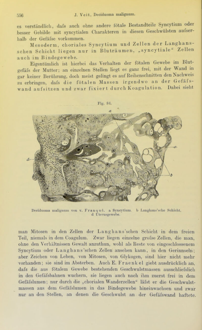 es verständlich, dafs auch ohne andere fötale Bestandteile Syncytiiim oder besser Gebilde mit syncytialen Charakteren in diesen Geschwülsten aufser- halb der Gefäfse vorkommen. Mesoderm, choriales Syncytium und Zellen der Langhans- schen Schicht liegen nur in Bluträumen, „ syncy tialeZellen auch im Bindegewebe. Eigentümlich ist hierbei das Verhalten der fötalen Gewebe im Blut- gefäfs der Mutter; an einzelnen Stellen liegt es ganz frei, mit der Wand in gar keiner Berührung, doch meist gelingt es auf Reihenschnitten den Nachweis zu erbringen, dafs die fötalen Massen irgendwo an der Gefäfs- wand aufsitzen und zwar fixiert durch Koagulation. Dabei sieht Fig. 84. Docidnoma malignnni von v. Frauque. a Syucytium. b Langhans'sche Schicht. d Utcrusgewebe. man Mitosen in den Zellen der Langhans'schen Schicht in dem freien Teil, niemals in dem Coagulum. Zwar liegen einzelne grofse Zellen, die man, ohne den Verhältnissen Gewalt anzuthun, wohl als Reste von eingeschlossenem Syncytium oder Langhans'sehen Zellen ansehen kann, in den Gerinnseln; aber Zeichen von Leben, von Mitosen, von Glykogen, sind hier nicht mehr vorhanden; sie sind im Absterben. Auch E. Fraenkel giebt ausdrücklich an. dafs die aus fötalem Gewebe bestehenden Geschwulstmassen ausschliefslich in den Gefäfsbahnen wuchern, sie liegen auch nach ihm zuerst frei in dem Gefäfslumen; nur durch die „chorialen Wanderzellen läfst er die Geschwulst- massen aus dem Gefäfslumen in das Bindegewebe hineinwachsen und zwar nur an den Stellen, an denen die Geschwulst an der Gefäfswand haftete.
