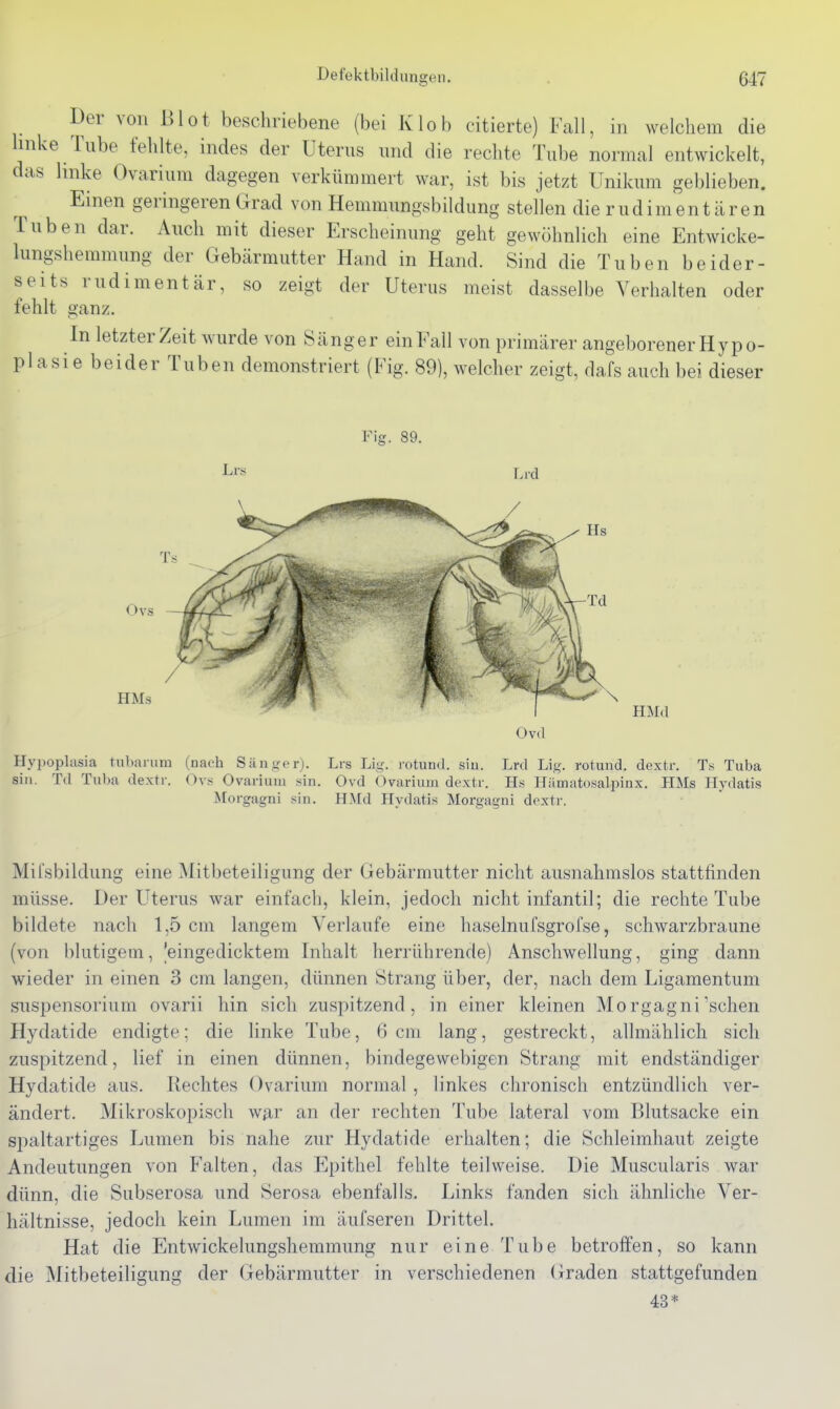 Der von ßlot beschriebene (bei Klob citierte) Fall, in welchem die linke Tube fehlte, indes der Uterus und die rechte Tube normal entwickelt, das linke Ovarium dagegen verkümmert war, ist bis jetzt Unikum geblieben. Einen geringeren Grad von Hemnmngsbildung stellen die rudimentären Tuben dar. Auch mit dieser Erscheinung geht gewöhnlich eine Entwicke- lungshemmung der Gebärmutter Hand in Hand. Sind die Tuben beider- seits rudimentär, so zeigt der Uterus meist dasselbe Verhalten oder fehlt ganz. In letzter Zeit wurde von Sänger ein Fall von primärer angeborener Hypo- plasie beider Tuben demonstriert (Fig. 89), welcher zeigt, dafs auch bei dieser Fig. 89. Lid Ovd Hypoplasia tnbanim (nach Sän.irer). Lrs Lig. rotund. siu. Lrd Lig. rotund. dextr. Ts Tuba sin. Td Tul)a dextr. Ov.< Ovarium sin. Ovd Ovarium dextr. Hs Hilmatosalpinx. HMs Ilydatis Morgagni sin. HMd Hydatis Morgagni dextr. Mii'sbildung eine Mitbeteiligung der Gebärmutter nicht ausnahmslos stattfinden müsse. Der Uterus war einfach, klein, jedoch nicht infantil; die rechte Tube bildete nach 1,5 cm langem Verlaufe eine haselnufsgrofse, schwarzbraune (von blutigem, |eingedicktem Inhalt herrührende) Anschwellung, ging dann wieder in einen 3 cm langen, dünnen Strang über, der, nach dem Ligamentum Suspensorium ovarii hin sich zuspitzend, in einer kleinen Mo rgagni'sehen Hydatide endigte; die linke Tube, 6 cm lang, gestreckt, allmählich sich zuspitzend, lief in einen dünnen, bindegewebigen Strang mit endständiger Hydatide aus. Rechtes Ovarium normal , linkes chronisch entzündlich ver- ändert. Mikroskopisch w^r an der rechten Tube lateral vom Blutsacke ein spaltartiges Lumen bis nahe zur Hydatide erhalten; die Schleimhaut zeigte Andeutungen von Falten, das Epithel fehlte teilweise. Die Muscularis war dünn, die Subserosa und Serosa ebenfalls. Links fanden sich ähnliche Ver- hältnisse, jedoch kein Lumen im äufseren Drittel. Hat die Entwickelungshemmung nur eine Tube betroffen, so kann die Mitbeteiligung der Gebärmutter in verschiedenen Graden stattgefunden 43*