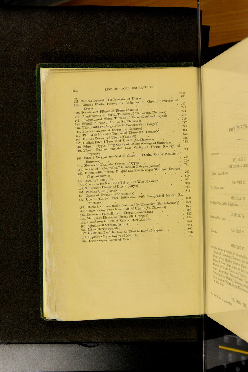 Xll Chronic Inversion of of 137 Barnes's Operation for Inversion of Uterus 188. B^Tes's Ilastic Pessary for Reduction of 139. StmcTe of FibroidL of ^^f^ms (St. Thomas's) HO. O^ ^S ut™ (London Hospital) 141. Sub-peritoneal Fibroid ^ ^^.^ . H2. Fibroid Tumour o f W*«(»t >b) < H3. Uterus with two QeQIge>s) • . . . 144. Fibrous Tumours of ™^ (st. Thoma8.s) . 145 Fibroid or Muscular lumour o is- ssr— °^ °f ute™^. 160. iZttir^ '» *^ - uteriM <C°Eege °* (Bartholomew'b) • • _ 164. Avelmg'sPolyptrite • • • ageur _ . . 155 Operation for Removing Polypus byMff S iercular Disease of Uterus (Guys) . • . .. . 157 Phthisis Uteri (Carswell) . • i ai Cancer eating away lower halt ot Uterus ^ 162 Pavement Epithelioma of Uterus (Lancereaus) - 63 Egnant Disease of Uterus (St. George s • 164 Cauhiower Growth of Cervix Uteri (Amott) 165 Spindle-cell Sarcoma (Arnott) 168. Syphilitic Hypertrophy of Nympha . 169. Hypertrophic Lupus of Vulva PAOK 735 151. 152. 153. 154. 737 742 744 745 740 747 749 751 753 750 783 784 785 790 791 799 800 801 808 809 818 819 , 820 821 . 822 . 823 . 824 . 825 . 853 . 863 . 883 . 884
