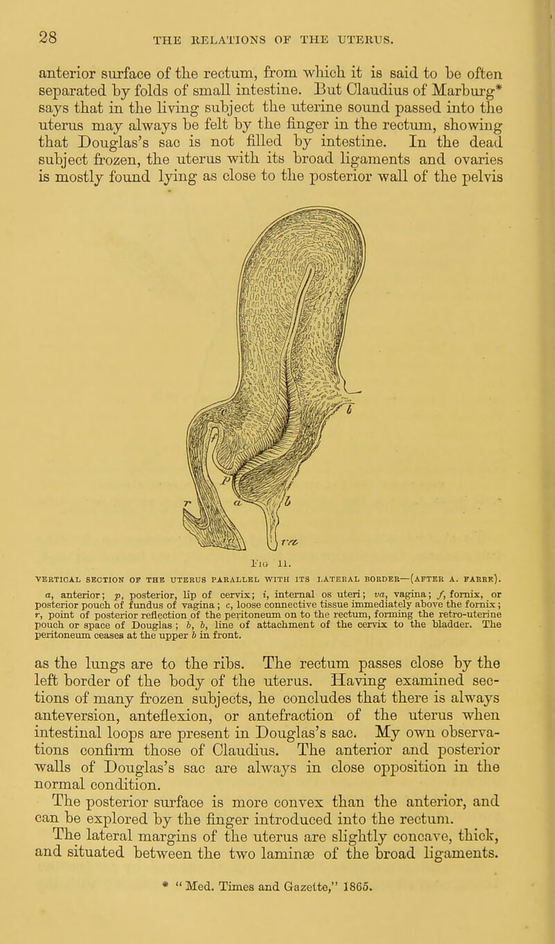anterior surface of the rectum, from which it is said to he often separated by folds of small intestine. But Claudius of Marhurg* says that in the living suhject the uterine sound passed into the uterus may always be felt hy the finger in the rectum, showing that Douglas's sac is not filled hy intestine. In the dead suhject frozen, the uterus with its broad ligaments and ovaries is mostly found lying as close to the posterior wall of the pelvis Eio 11. VERTICAL SECTION OF THE UTERU8 PARALLEL WITH ITS LATERAL BORDER—(AFTER A. FARRe). a, anterior; p, posterior, lip of cervix; i, internal os uteri; va, vagina; /, fornix, or posterior pouch of fundus of vagina; c, loose connective tissue immediately above the fornix; r, point of posterior reflection of the peritoneum on to the rectum, forming the retro-uterine pouch or space of Douglas ; b, b, line of attachment of the cervix to the bladder. The peritoneum ceases at the upper b in front. as the lungs are to the ribs. The rectum passes close by the left border of the body of the uterus. Having examined sec- tions of many frozen subjects, he concludes that there is always anteversion, anteflexion, or antefraction of the uterus when intestinal loops are present in Douglas's sac. My own observa- tions confirm those of Claudius. The anterior and posterior walls of Douglas's sac are always in close opposition in the normal condition. The posterior surface is more convex than the anterior, and can be explored by the finger introduced into the rectum. The lateral margins of the uterus are slightly concave, thick, and situated between the two laminae of the broad ligaments. *  Med. Times and Gazette, 1865.