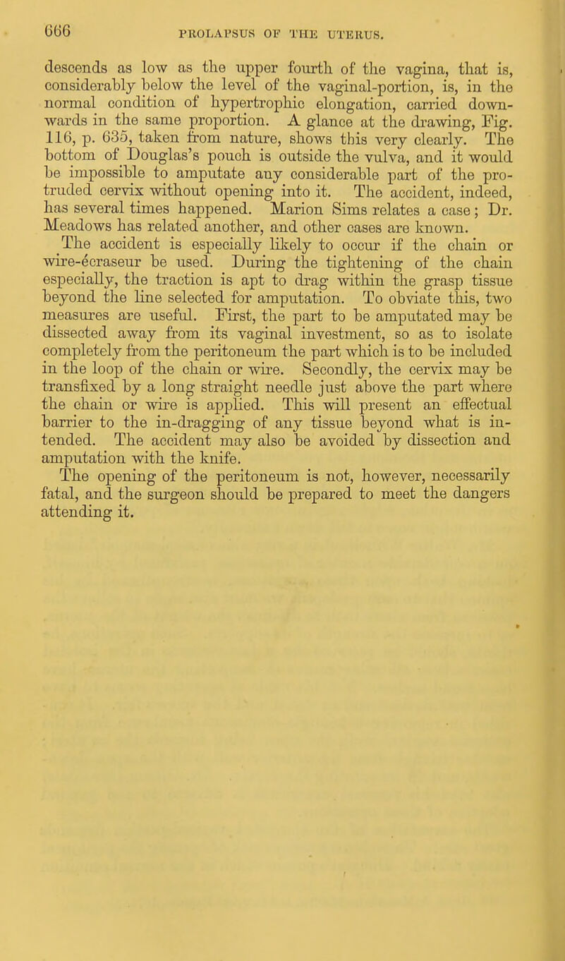 descends as low as the upper fourth of the vagina, that is, considerably below the level of the vaginal-portion, is, in the normal condition of hypertrophic elongation, carried down- wards in the same proportion. A glance at the drawing, Fig. 116, p. 635, taken from nature, shows this very clearly. The bottom of Douglas's pouch is outside the vulva, and it would be impossible to amputate any considerable part of the pro- truded cervix without opening into it. The accident, indeed, has several times happened. Marion Sims relates a case; Dr. Meadows has related another, and other cases are known. The accident is especially likely to occur if the chain or wire-ecraseur be used. During the tightening of the chain especially, the traction is apt to drag within the grasp tissue beyond the line selected for amputation. To obviate this, two measures are useful. First, the part to be amputated may be dissected away from its vaginal investment, so as to isolate completely from the peritoneum the part which is to be included in the loop of the chain or wire. Secondly, the cervix may be transfixed by a long straight needle just above the part where the chain or wire is applied. This will present an effectual barrier to the in-dragging of any tissue beyond what is in- tended. The accident may also be avoided by dissection and amputation with the knife. The opening of the peritoneum is not, however, necessarily fatal, and the surgeon should be prepared to meet the dangers attending it.