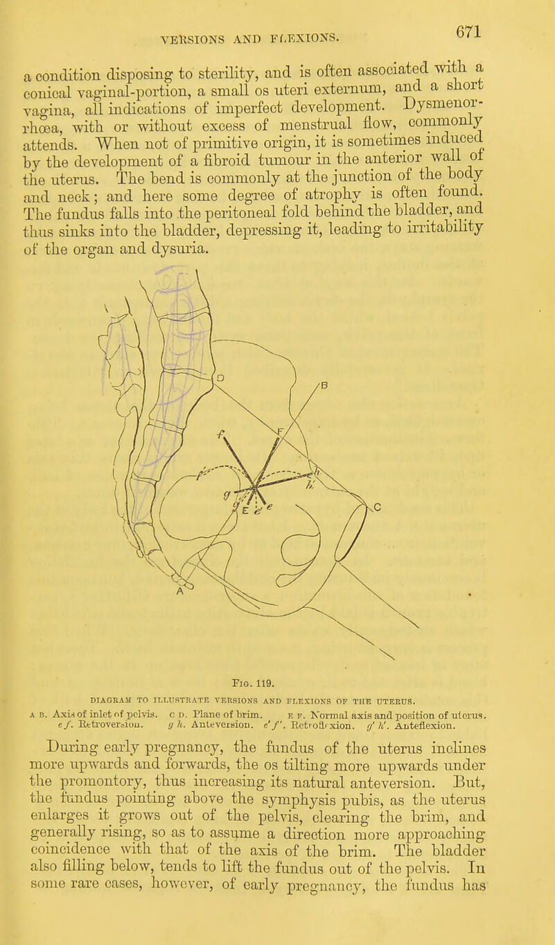 a condition disposing to sterility, and is often associated with a conical vaginal-portion, a small os uteri externum, and a snort vagina, all indications of imperfect development. Dysmenor- rhea, with or without excess of menstrual flow, oommoaly attends. When not of primitive origin, it is sometimes induced hy the development of a fibroid tumour in the anterior wall oi the uterus. The bend is commonly at the junction of the body and neck; and here some degree of atrophy is often found. The fundus falls into the peritoneal fold behind the bladder, and thus sinks into the bladder, depressing it, leading to irritability of the organ and dysuria. Fig. 119. diagram to illustrate versions and fluxions ov the uteeus. a d. Axw of inlet of pelvis, c d. Plane of brim. e f. Normal axis and position of uterus. ef. Kttrovei'aiou. y h. Anteversiou. e'f. Retroilf xion. g' it. Anteflexion. During early pregnancy, the fundus of the uterus inclines more upwards and forwards, the os tilting more upwards under the promontory, thus increasing its natural anteversion. But, the fundus pointing above the symphysis pubis, as the uterus enlarges it grows out of the pelvis, clearing the brim, and generally rising, so as to assume a direction more approaching coincidence with that of the axis of the brim. The bladder also filling below, tends to lift the fundus out of the pelvis. In some rare cases, however, of early pregnancy, the fundus has