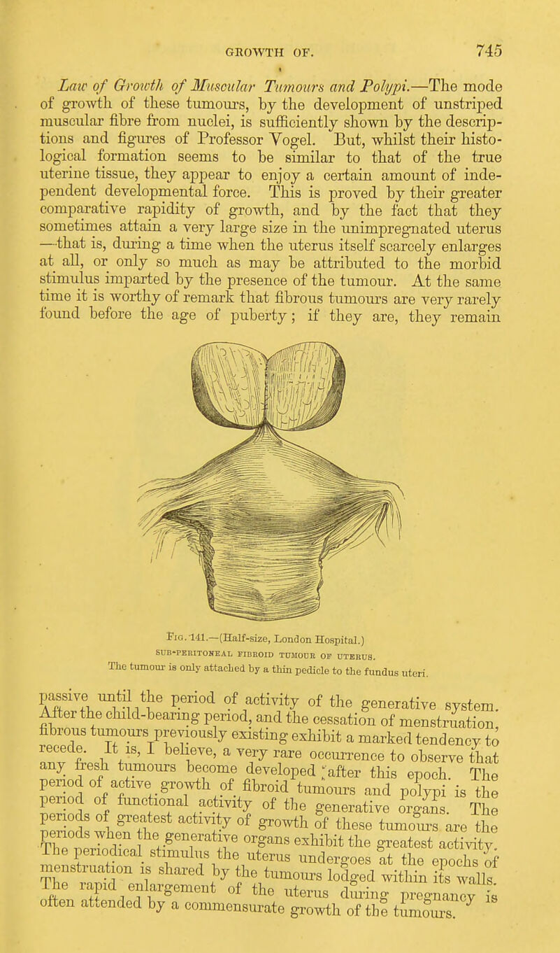 Laic of Growth of Muscular Tumours and Polypi.—The mode of growth, of these tumours, by the development of unstriped muscular fibre from nuclei, is sufficiently shown by the descrip- tions and figures of Professor Vogel. But, whilst their histo- logical formation seems to be similar to that of the true uterine tissue, they appear to enjoy a certain amount of inde- pendent developmental force. This is proved by their greater comparative rapidity of growth, and by the fact that they sometimes attain a very large size in the unimpregnated uterus —that is, during a time when the uterus itself scarcely enlarges at all, or only so much as may be attributed to the morbid stimulus imparted by the presence of the tumour. At the same time it is worthy of remark that fibrous tumours are very rarely found before the age of puberty; if they are, they remain Fig. 141— (Half-size, London Hospital.) SUB-PERITOHEAL FIBROID TUMOUR OF UTERUS. The tumour is only attached by a thin pedicle to the fundus uteri passive until the period of activity of the generative system. After the child-bearing period, and the cessation of menstruation, fibrous tumours previously existing exhibit a marked tendency to recede. It is, I believe, a very rare occurrence to observe that any fresh tumours become developed ;after this epoch. The period of active growth of fibroid tumours and polypi is the period of functional activity of the generative organs. The periods of greatest activity of growth of these tumom-s are the ■SwI r hVgeTa^e °^ans eshibit the latest activity! The periodical stimulus the uterus undergoes at the epochs of menstruation is shared by the tumours lodged within i s walls The rapid enlargement of the uterus during pregnane is often attended by a commensurate growth of tbf tumour s *