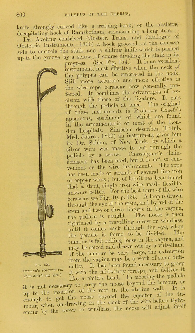knife strongly curved like a reaping-hook, or the oM&rti} decapitating hook of Earasbotham, surmounting a Long M om. T)r Aveling contrived (Obstetr. Trans, and Catalogue ot Obstetric Instruments, 1800) a hook grooved on the concave side to encircle the stalk, and a sliding knife which is punned tro to the groove by a screw, of course dividing the stalk m its 1 progress. (See Fig. 154.) It is an excellent instrument, most effective when the neck oi the polypus can be embraced in the hook. If Still more accurate and more effective is ^ the wire-rope ecraseur now generally pre- ferred. It combines the advantages of ex- cision with those of the ligature. It cuts through the pedicle at once. The original of these instruments is Professor Orestes apparatus, specimens of which are found in the armamentaria of most of the .Lon- don hospitals. Simpson' describes (Edinb. Med. Journ., 1850) an instrument given him by Dr. Sabine, of New York, by which a silver wire was made to cut through the pedicle by a screw. Chassaignac's cham- e^raseur has been used, but it is not so con- venient as the wire instruments. Ihe rope has been made of strands of several fine iron or copper wires ; but of late it has been found that a stout, single iron wire made flexible, answers better. For the best form of the we ecraseur, see Fig. 40, p. 135. A loop is drawn through the eye of the stem, and by aid oi tne stem and two or three fingers in the vagina, the pedicle is caught. The noose is then tightened by a travelling screw or windlass, until it conies back through the eye, when the pedicle is found to be divided. Ihe tumour is felt rolling loose in the vagina, and may be seized and drawn out by a vulseUum. If the tumour be very large, the extraction from the vagina may be a work of some diffi- culty. It has been found necessary to grasp it with the midwifery forceps, and deliver it like a child's head. In noosing the pedicle •f ;« ™t necessary to carry the noose beyond the tumour, or In Jhe Insertion of the root in the uterine wall It is up to the^™ h d the uator of the u- enough to get tire J ^ ^ t h ening'by the° sctw or* windlass, the noose will adjust itself Fig. 151. AVRUNO'S POLYPTKITE. (One-third nat. size.)