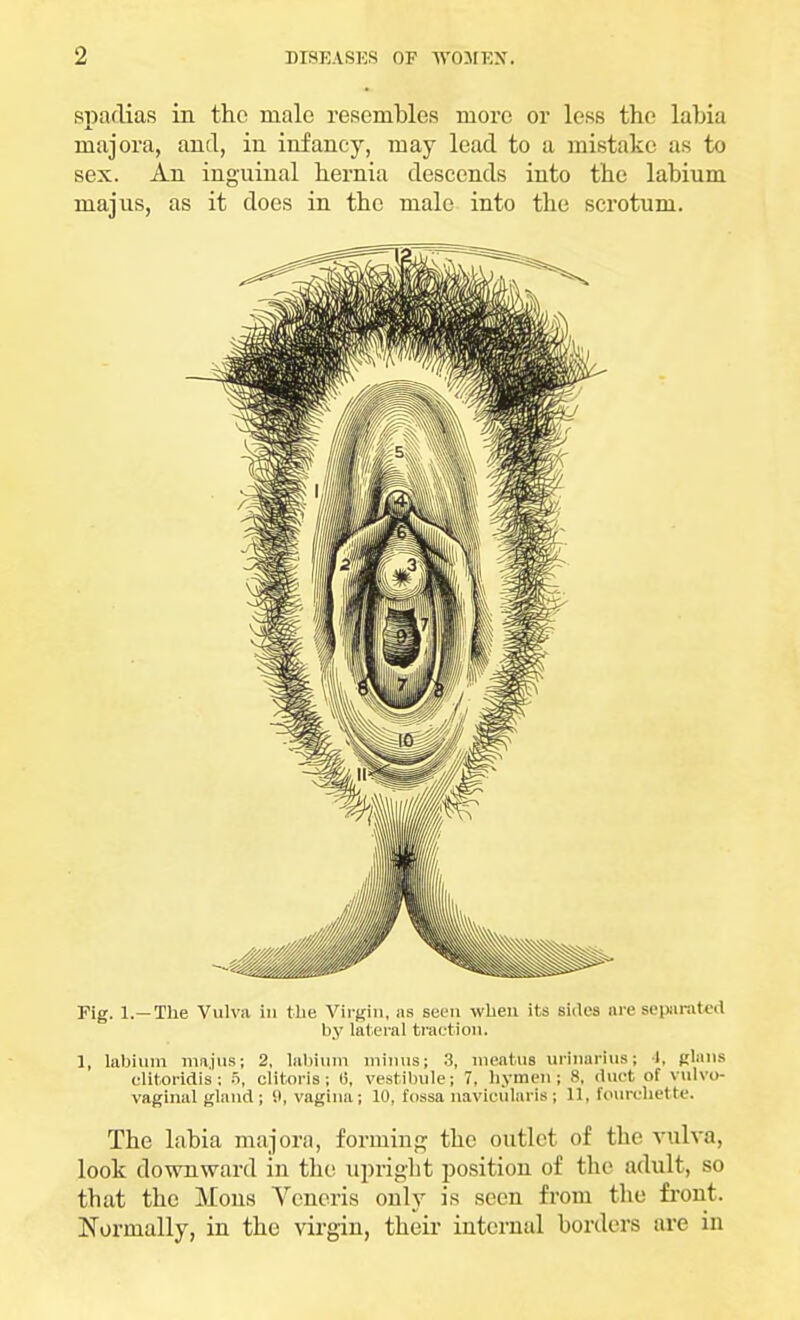 spadias in the male resembles more or less the labia majora, and, in infancy, may lead to a mistake as to sex. An inguinal hernia descends into the labium niajus, as it does in the male into the scrotum. Fig. 1.— The Vulva in the Virgin, as seen when its sides are separated by lateral traction. 1, labium majus; 2, labium minus; 3, meatus urinarius; 4, plans clitoridis; 5, clitoris; (5, vestibule; 7, hymen; 8, duet of vulvo- vaginal gland; si, vagina; 10, fossanavicularis; 11, fourchette. The labia majora, forming the outlet of the vulva, look downward in the upright position of the adult, so that the Mons Veneris only is seen from the front, Normally, in the virgin, their internal borders arc in