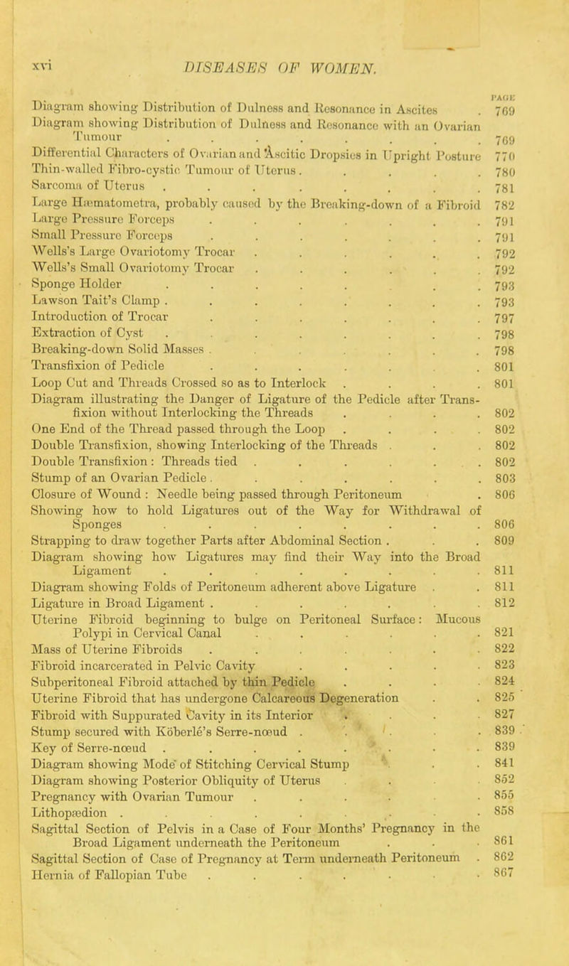 . PA0E Diagram showing Distribution of Dulnoss and Resonance in Ascites . 769 Diagram showing Distribution of Dulness and Resonance with an Ovarian Tumour ...... 769 Differential Characters of Ovarian and'Ascitic Dropsies in Upright Posture 770 Thin-walled Fibro-eystie Tumour of Uterus ..... 780 Sarcoma of Uterus . . . . . . . .781 Large Ha>matometra, probably caused by the Breaking-down of a Fibroid 782 Large Pressure Forceps . . . . . , .791 Small Pressure Forceps . . . . . . .791 Wells's Large Ovariotomy Trocar ...... 792 Wells's Small Ovariotomy Trocar ...... 792 Sponge Holder ..... . . 793 Lawson Tait's Clamp ........ 793 Introduction of Trocar ....... 797 Extraction of Cyst . . . . . . . . 798 Breaking-down Solid Masses ... ... 798 Transfixion of Pedicle . . . . . .801 Loop Cut and Threads Crossed so as to Interlock . . . .801 Diagram illustrating the Danger of Ligature of the Pedicle after Trans- fixion without Interlocking the Threads .... 802 One End of the Thread passed through the Loop .... 802 Double Transfixion, showing Interlocking of the Threads . . . 802 Double Transfixion : Threads tied ...... 802 Stump of an Ovarian Pedicle ....... 803 Closure of Wound : Needle being passed through Peritoneum . 806 Showing how to hold Ligatures out of the Way for Withdrawal of Sponges ........ 806 Strapping to draw together Parts after Abdominal Section . . . 809 Diagram showing how Ligatures may find their Way into the Broad Ligament . . . . . . . .811 Diagram showing Folds of Peritoneum adherent above Ligature . .811 Ligature in Broad Ligament . . . . .812 Uterine Fibroid beginning to bulge on Peritoneal Surface: Mucous Polypi in Cervical Canal . . . . .821 Mass of Uterine Fibroids ....... 822 Fibroid incarcerated in Pelvic Cavity ..... 823 Subperitoneal Fibroid attached by thin Pedicle .... 824 Uterine Fibroid that has undergone Calcareous Degeneration . . 825 Fibroid with Suppurated Cavity in its Interior .... 827 Stump secured with Koberle's Serre-ncoud .... 839 Key of Serre-nceud ....... 839 Diagram showing Mode of Stitching Cervical Stump V . .841 Diagram showing Posterior Obliquity of Uterus . . 862 Pregnancy with Ovarian Tumour .... • 855 Lithopajdion . . . . . . . • 808 Sagittal Section of Pelvis in a Case of Four Months' Pregnancy in the Broad Ligament underneath the Peritoneum . . .861 Sagittal Section of Case of Pregnancy at Term underneath Peritoneum . 862 Hernia of Fallopian Tube . . . . . .86/