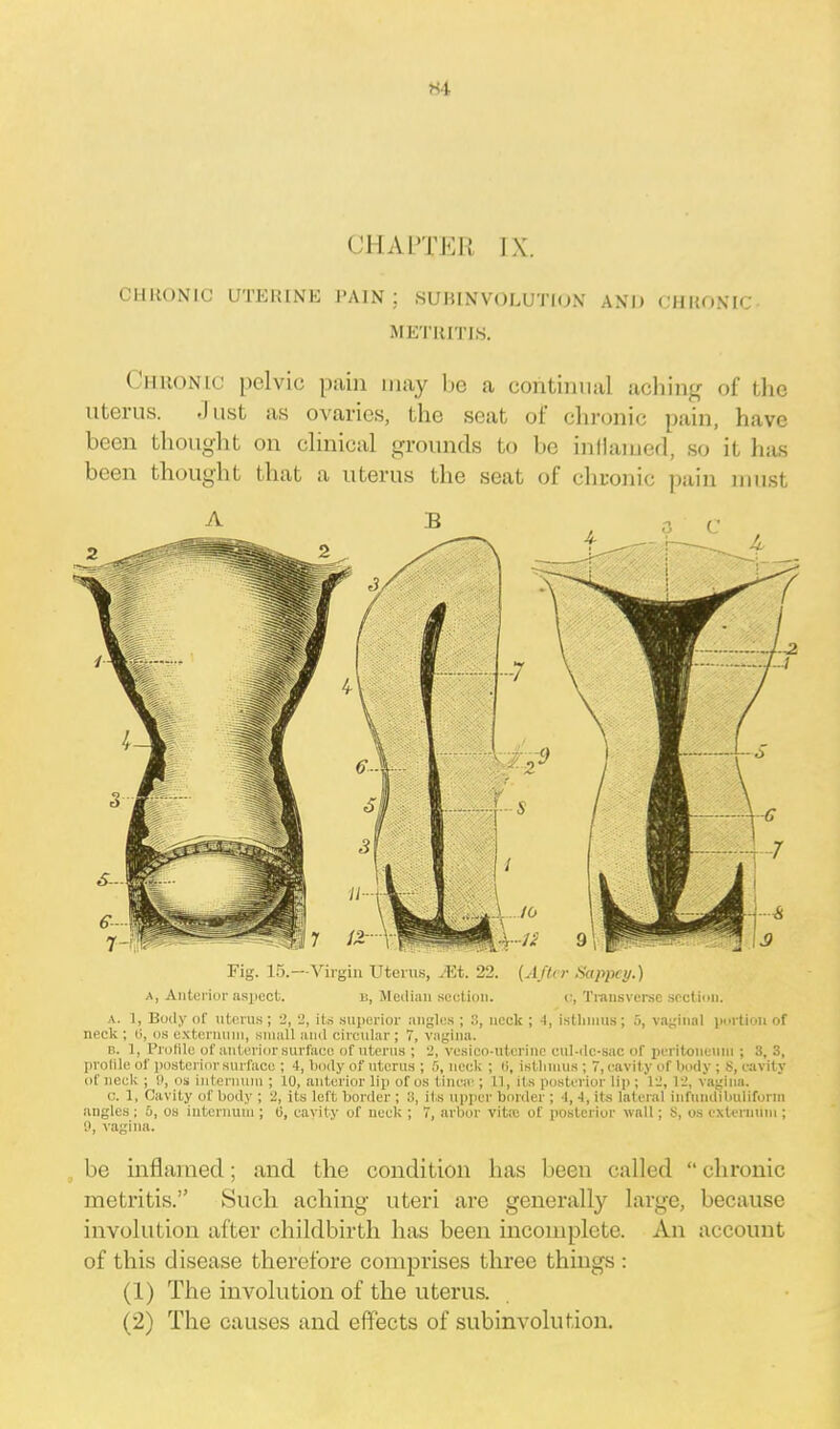 CHAPTER IX. CHRONIC UTERINE RAIN : SUBINVOLUTION AND CHRONIC METRITIS. Chronic pelvic pain may he a continual aching of the uterus. .lust as ovaries, the seat of chronic pain, have been thought on clinical grounds to he inflamed, so it has been thought that a uterus the seat of chronic pain must A ;b Fig. 15.—Virgin Uterus, JEt. 22. (After Sappey.) a, Anterior aspect, b, Median section. p. Transverse section. a. I, Body of uterus ; 2, 2, its superior angles ; 3, neck ; 4, isthmus; 5, vaginal portion of neck ; ti, os externum, small and circular; 7, vagina. b. 1, Profile of anterior surface of uterus ; 2, vesico-uterine cul-de-sac of peritoneum ; 3, 3, prolile of posterior Surface ; 4, body of uterus ; 5, neck ; li, isthmus ; 7, cavity of body ; S, cavity of neck; 9, os internum ; 10, anterior lip of os tinea1; 11, its posterior lip ; 12, 12, vagina. c. 1, Cavity of body ; 2, its left border ; 3, its upper border ; 4, 4, its lateral infundibuliform angles; 5, os internum ; G, cavity of neck ; 7, arbor vitre of posterior wall; s, os externum ; 9, vagina. „ be inflamed; and the condition has been called  chronic metritis. Such aching uteri are generally large, because involution after childbirth has been incomplete. An account of this disease therefore comprises three things : (1) The involution of the uterus. (2) The causes and effects of subinvolution.