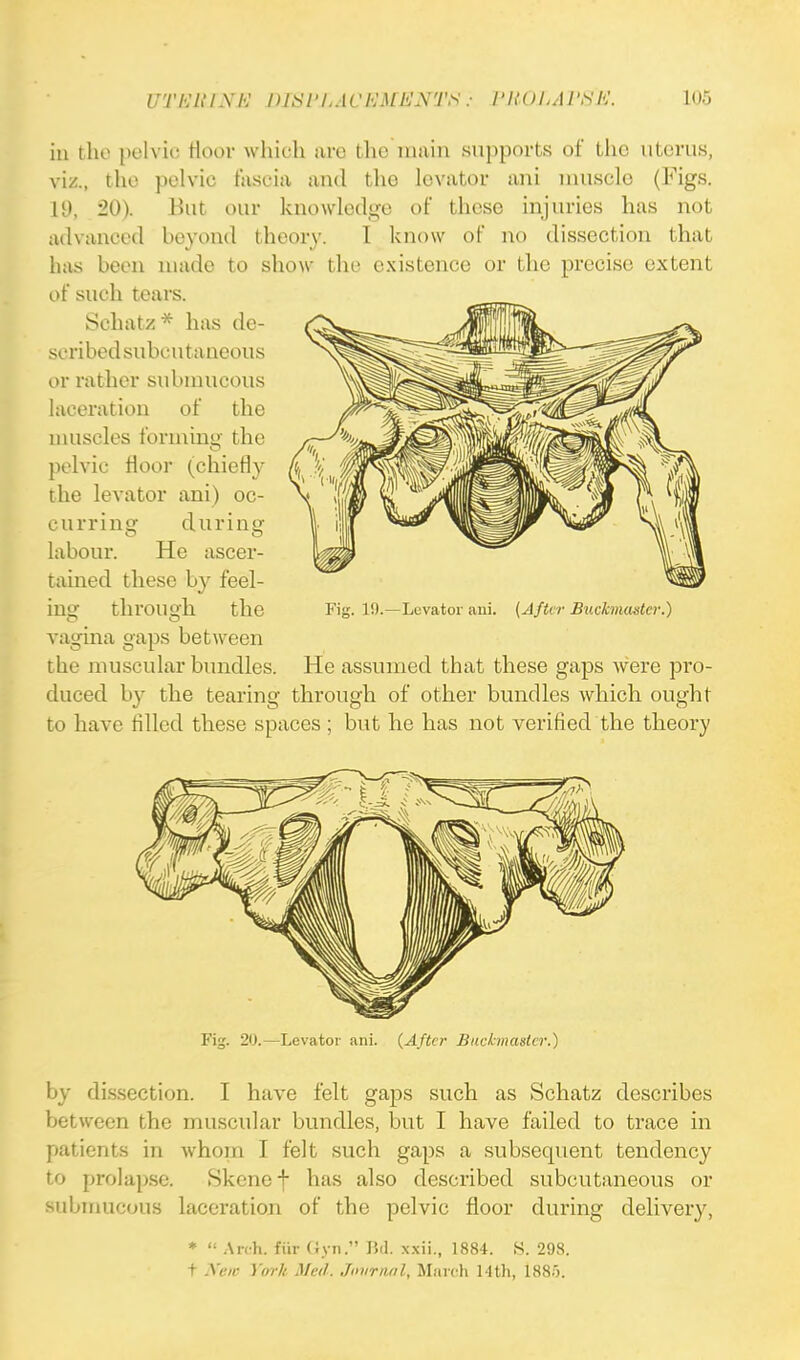 in the pelvic Hoor which arc the main supports of the uterus, viz., the pelvic fascia and the levator ani muscle (Figs. 19, 20). But our knowledge of these injuries has not advanced beyond theory. I know of no dissection that has been made to show the existence or the precise extent of such tears. Schatz* has de- scribed subcutaneous or rather submucous laceration of the muscles forming the pelvic floor (chiefly the levator ani) oc- curring during labour. He ascer- tained these by feel- ing through the vagina gaps between the muscular bundles duceel by the tearing through of other bundles which ought to have tilled these spaces ; but he has not verified the theory Fig. 20.—Levator ani. (After Buckmasier.) by dissection. I have felt gaps such as Schatz describes between the muscular bundles, but I have failed to trace in patients in whom I felt such gaps a subsequent tendency to prolapse. Skenef has also described subcutaneous or submucous laceration of the pelvic floor during delivery, *  Arch, fur Gyn. lid. xxii., 1884. S. 298. t Nen Yorll Med. Journal, March 14th, 188). Fig. 19.—Levator aui. (Aftcr Bucknuustcr.) He assumed that these gaps were pro-