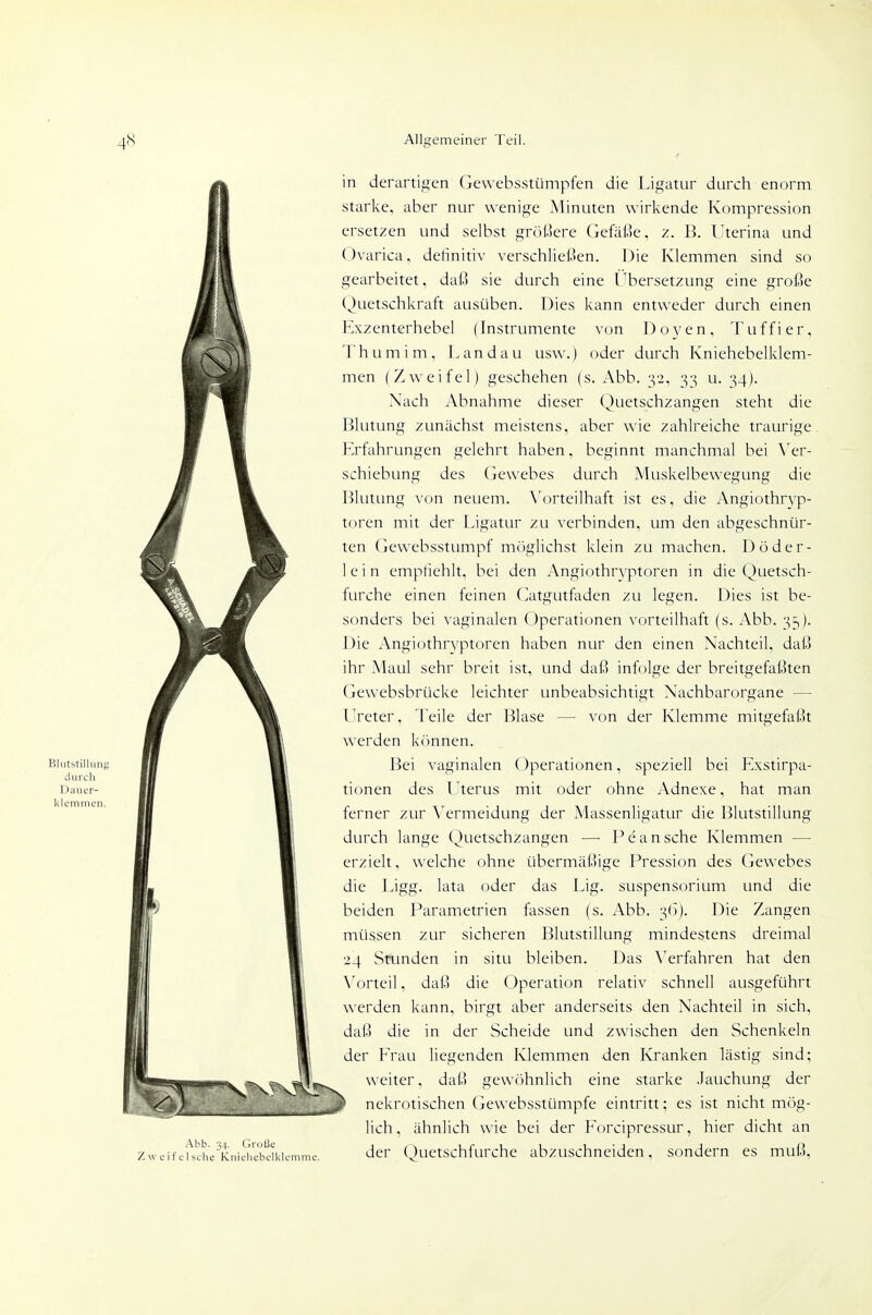 in derartigen Gewebsstümpfen die Ligatur durch enorm starke, aber nur wenige Minuten wirkende Kompression ersetzen und selbst größere Gefäße, z. B. Uterina und Ovarica, dertnitiv verschließen. Die Klemmen sind so gearbeitet, daß sie durch eine Übersetzung eine große Quetschkraft ausüben. Dies kann entweder durch einen Exzenterhebel (Instrumente von Doyen, Tuffier, Thumim, Landau usw.) oder durch Kniehebelklem- men (Zweifel) geschehen (s. Abb. '^2, •^••^ u. '^4). Nach Abnahme dieser Quetschzangen steht die Blutung zunächst meistens, aber wie zahlreiche traurige, Erfahrungen gelehrt haben, beginnt manchmal bei Ver- schiebung des Gewebes durch Muskelbewegung die Blutung von neuem. \^orteilhaft ist es, die Angiothryp- toren mit der Ligatur zu verbinden, um den abgeschnür- ten Gewebsstumpf mciglichst klein zu machen. Döder- 1 e i n empfiehlt, bei den Angiothryptoren in die Quetsch- furche einen feinen Catgutfaden zu legen. Dies ist be- sonders bei vaginalen Operationen vorteilhaft (s. Abb. 35). Die Angiothryptoren haben nur den einen Nachteil, daß ihr Maul sehr breit ist, und daß infolge der breitgefaßten Gewebsbrücke leichter unbeabsichtigt Nachbarorgane — LIreter, Teile der Blase — von der Klemme mitgefaßt werden kcmnen. Bei vaginalen Operationen, speziell bei Exstirpa- tionen des Uterus mit oder ohne Adnexe, hat man ferner zur ^^ermeidung der Massenligatur die Blutstillung durch lange Quetschzangen —■ P e a n sehe Klemmen —• erzielt, welche ohne übermäßige Pression des Gewebes die Ligg. lata oder das Lig. Suspensorium und die beiden Parametrien fassen (s. Abb. 36). Die Zangen müssen zur sicheren Blutstillung mindestens dreimal 24 Stunden in situ bleiben. Das \^erfahren hat den Vorteil, daß die Operation relativ schnell ausgeführt werden kann, birgt aber anderseits den Nachteil in sich, daß die in der Scheide und zwischen den Schenkeln der Frau liegenden Ivlemmen den Kranken lästig sind; weiter, daß gewöhnlich eine starke Jauchung der y nekrotischen Gewebsstümpfe eintritt; es ist nicht mög- lich, ähnlich wie bei der Forcipressur, hier dicht an der Quetschfurche abzuschneiden, sondern es muß,
