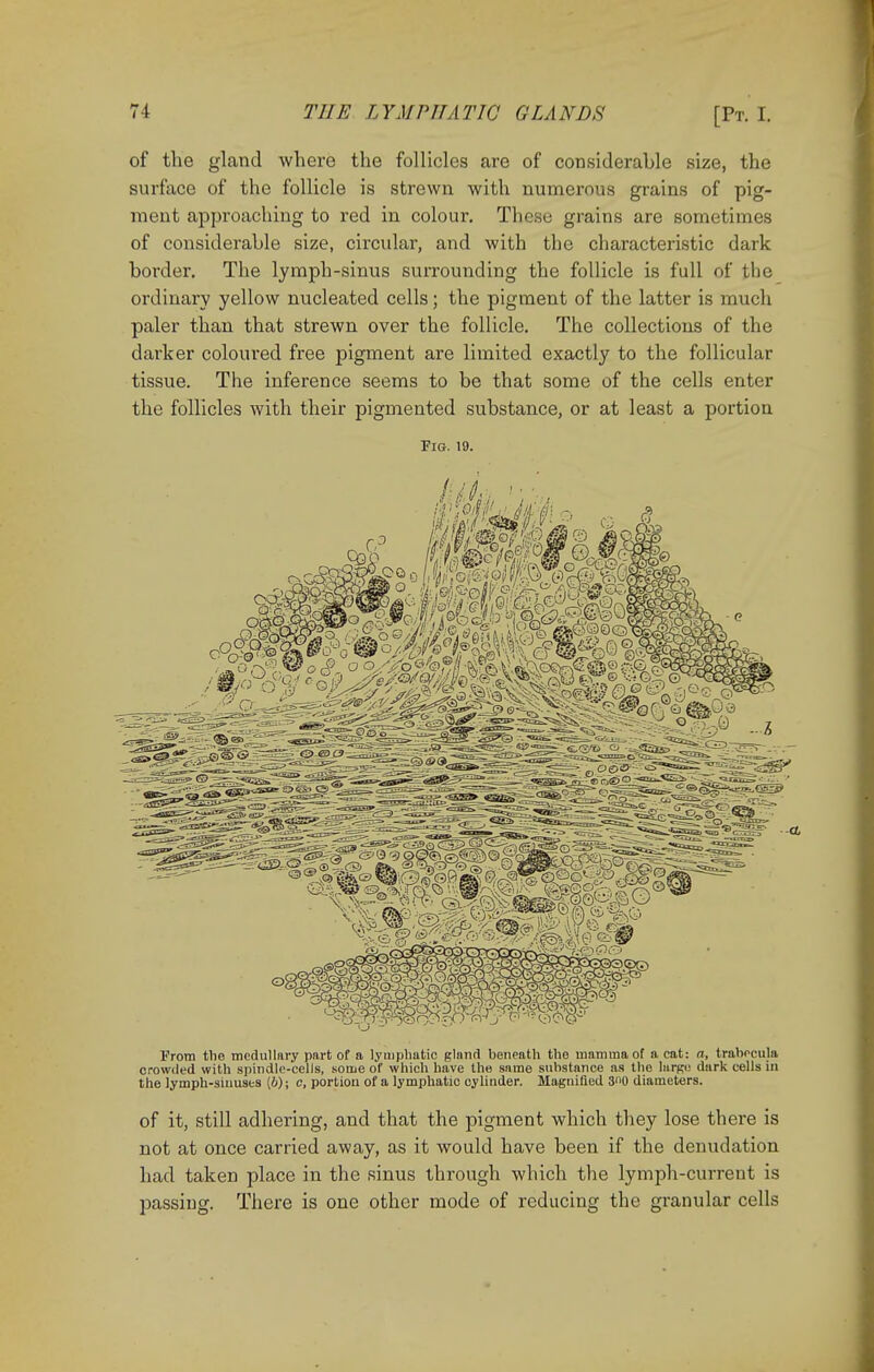 of the gland where the follicles are of considerable size, the surface of the follicle is strewn with numerous grains of pig- ment approaching to red in colour. These grains are sometimes of considerable size, circular, and with the characteristic dark border. The lymph-sinus surrounding the follicle is full of the ordinary yellow nucleated cells; the pigment of the latter is much paler than that strewn over the follicle. The collections of the darker coloured free pigment are limited exactly to the follicular tissue. The inference seems to be that some of the cells enter the follicles with their pigmented substance, or at least a portion Fig. 19. Prom the medullary part of a lymphatic gland beneath the mamma of a cat: a, trabecula crowded with spindle-cells, some of which have the same substance as the large dark cells in the iymph-siuusts \b); c, portion of a lymphatic cylinder. Magnified 30 diameters. of it, still adhering, and that the pigment which they lose there is not at once carried away, as it would have been if the denudation had taken place in the sinus through which the lymph-current is passing. There is one other mode of reducing the granular cells