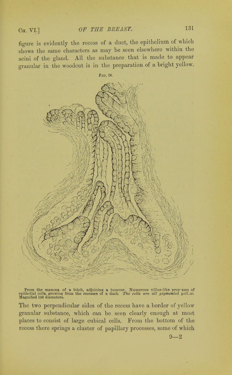 figure is evidently the recess of a duct, the epithelium of which shows the same characters as may be seen elsewhere within the acini of the gland. All the substance that is made to appear granular in the woodcut is in the preparation of a bright yellow. Pig. 24. From the mamma of a bitch, adjoining a tumour. Numerous villus-like procrsses of epithelial cells, growing from the recesses of a duet. The cells are all pigmented yellow. Magnified 150 diameters. The two perpendicular sides of the recess have a border of yellow granular substance, which can be seen clearly enough at most places to consist of large cubical cells. From the bottom of the recess there springs a cluster of papillary processes, some of which 9—2