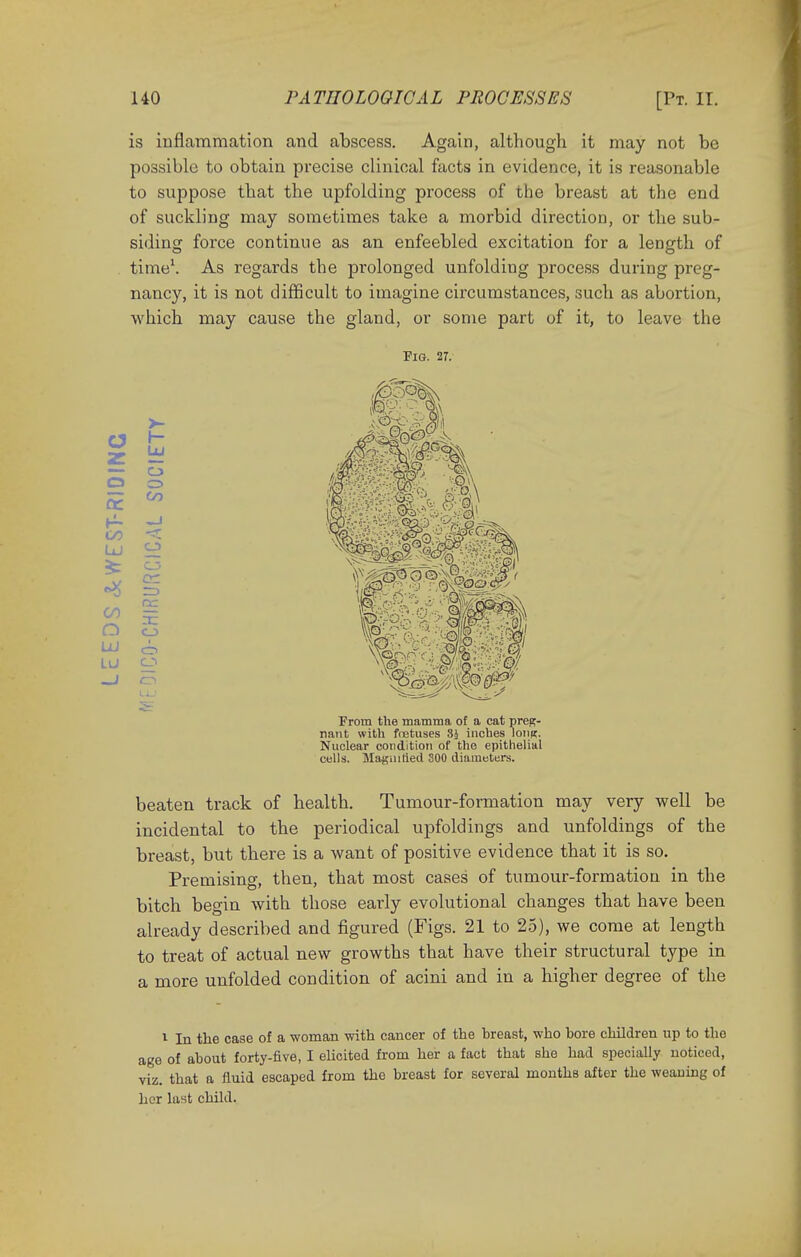 is inflammation and abscess. Again, although it may not bo possible to obtain precise clinical facts in evidence, it is reasonable to suppose that the upfolding process of the breast at the end of suckling may sometimes take a morbid direction, or the sub- siding force continue as an enfeebled excitation for a length of time1. As regards the prolonged unfolding process during preg- nancy, it is not difficult to imagine circumstances, such as abortion, which may cause the gland, or some part of it, to leave the Pig. 27. ZL LU z _ — o GO o i cr> en From the mamma of a cat preg- nant with foetuses 8J inches lontt. Nuclear condition of the epithelial cells. Magnified 300 diameters. beaten track of health. Tumour-formation may very well be incidental to the periodical upfoldings and unfoldings of the breast, but there is a want of positive evidence that it is so. Premising, then, that most cases of tumour-formation in the bitch begin with those early evolutional changes that have been already described and figured (Figs. 21 to 25), we come at length to treat of actual new growths that have their structural type in a more unfolded condition of acini and in a higher degree of the 1 In tlie case of a woman with cancer of the hreast, who bore children up to tho age of about forty-five, I elicited from her a fact that she had specially noticed, viz. that a fluid escaped from the breast for several months after the weaning of her last child.