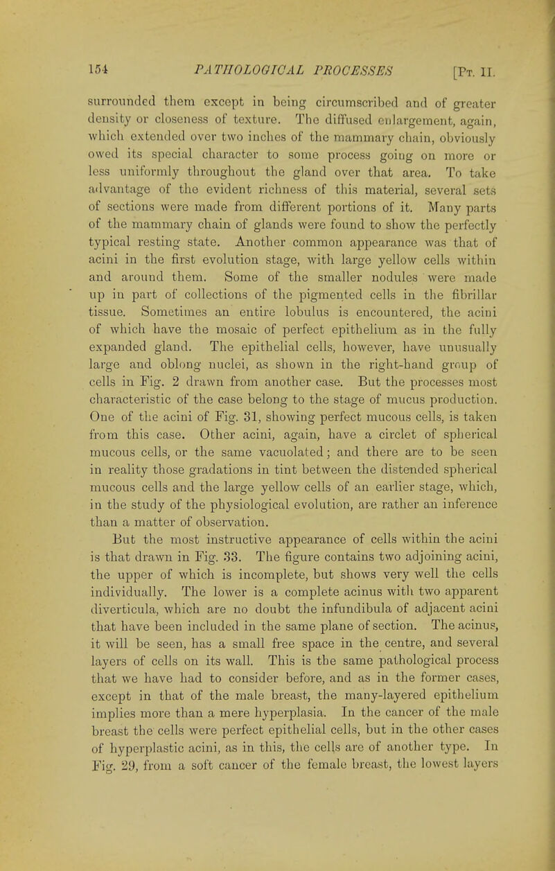 surrounded them except in being circumscribed and of greater density or closeness of texture. The diffused enlargement, again, which extended over two inches of the mammary chain, obviously owed its special character to some process going on more or less uniformly throughout the gland over that area. To take advantage of the evident richness of this material, several sets of sections were made from different portions of it. Many parts of the mammary chain of glands were found to show the perfectly typical resting state. Another common appearance was that of acini in the first evolution stage, with large yellow cells within and around them. Some of the smaller nodules were made up in part of collections of the pigmented cells in the fibrillar tissue. Sometimes an entire lobulus is encountered, the acini of which have the mosaic of perfect epithelium as in the fully expanded gland. The epithelial cells, however, have unusually large and oblong nuclei, as shown in the right-hand group of cells in Fig. 2 drawn from another case. But the processes most characteristic of the case belong to the stage of mucus production. One of the acini of Fig. 31, showing perfect mucous cells, is taken from this case. Other acini, again, have a circlet of spherical mucous cells, or the same vacuolated; and there are to be seen in reality those gradations in tint between the distended spherical mucous cells and the large yellow cells of an earlier stage, which, in the study of the physiological evolution, are rather an inference than a matter of observation. But the most instructive appearance of cells within the acini is that drawn in Fig. 33. The figure contains two adjoining acini, the upper of which is incomplete, but shows very well the cells individually. The lower is a complete acinus with two apparent diverticula, which are no doubt the infundibula of adjacent acini that have been included in the same plane of section. The acinus, it will be seen, has a small free space in the centre, and several layers of cells on its wall. This is the same pathological process that we have had to consider before, and as in the former cases, except in that of the male breast, the many-layered epithelium implies more than a mere hyperplasia. In the cancer of the male breast the cells were perfect epithelial cells, but in the other cases of hyperplastic acini, as in this, the cells are of another type. In Fi°\ 29, from a soft cancer of the female breast, the lowest layers