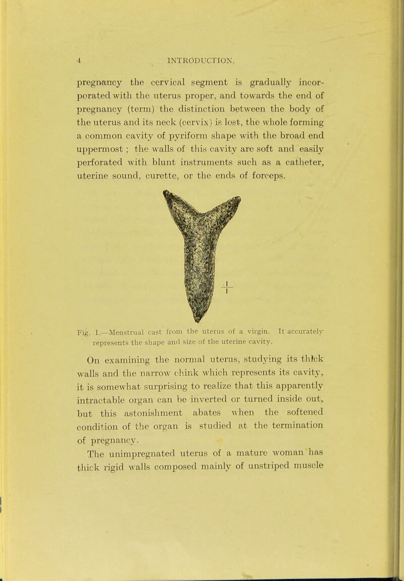 pregnancy the cervical segment is gradually incor- porated with the uterus proper, and towards the end of pregnancy (term) the distinction between the body of the uterus and its neck (cervix) is lost, the whole forming a common cavity of pyriform shape with the broad end uppermost ; the walls of this cavity are soft and easily perforated with blunt instruments such as a catheter, uterine sound, curette, or the ends of forceps. Fig. 1.—Menstrual cast from the uterus of a virgin. It accurately represents the shape and size of the uterine cavity. On examining the normal uterus, studying its thick walls and the narrow chink which represents its cavity, it is somewhat surprising to realize that this apparently intractable organ can be inverted or turned inside out, but this astonishment abates when the softened condition of the organ is studied at the termination of pregnancy. The unimpregnated uterus of a mature woman has thick rigid walls composed mainly of unstriped muscle