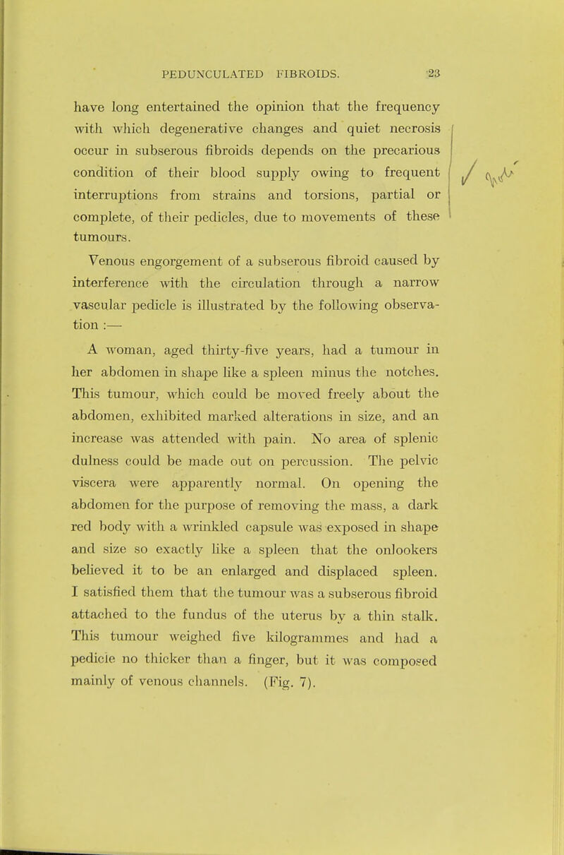 have long entertained the opinion that the frequency with which degenerative changes and quiet necrosis occur in subserous fibroids depends on the precarious condition of their blood supply owing to frequent interruptions from strains and torsions, partial or complete, of their pedicles, due to movements of these tumours. Venous engorgement of a subserous fibroid caused by interference with the circulation through a narrow vascular pedicle is illustrated by the following observa- tion :— A woman, aged thirty-five years, had a tumour in her abdomen in shape like a spleen minus the notches. This tumour, which could be moved freely about the abdomen, exhibited marked alterations in size, and an increase was attended with pain. No area of splenic dulness could be made out on percussion. The pelvic viscera were apparently normal. On opening the abdomen for the purpose of removing the mass, a dark red body with a wrinkled capsule was exposed in shape and size so exactly like a spleen that the onlookers believed it to be an enlarged and displaced spleen. I satisfied them that the tumour was a subserous fibroid attached to the fundus of the uterus by a thin stalk. This tumour weighed five kilogrammes and had a pedicle no thicker than a finger, but it was composed mainly of venous channels. (Fig. 7).