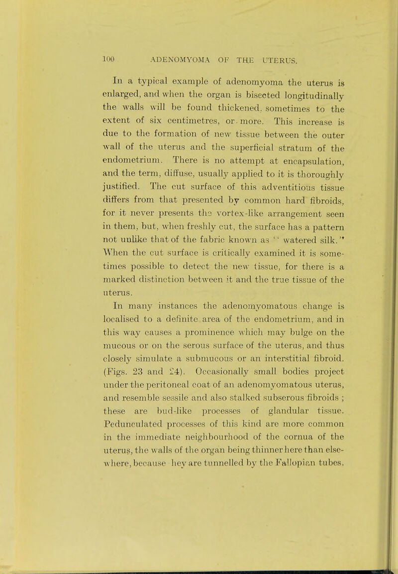 In a typical example of adenomyoma the uterus is enlarged, and when the organ is bisected longitudinally the walls will be found thickened, sometimes to the extent of six centimetres, or. more. This increase is due to the formation of new tissue between the outer wall of the uterus and the superficial stratum of the endometrium. There is no attempt at encapsulation, and the term, diffuse, usually applied to it is thoroughly justified. The cut surface of this adventitious tissue differs from that presented by common hard fibroids, for it never presents ths vortex-like arrangement seen in them, but, when freshly cut, the surface has a pattern not unlike that of the fabric known as '1 watered silk. When the cut surface is critically examined it is some- times possible to detect the new tissue, for there is a marked distinction between it and the true tissue of the uterus. In many instances the adenomyomatous change is localised to a definite area of the endometrium, and in this way causes a prominence which may bulge on the mucous or on the serous surface of the uterus, and thus closely simulate a submucous or an interstitial fibroid. (Figs. 23 and ~2±). Occasionally small bodies project under the peritoneal coat of an adenomyomatous uterus, and resemble sessile and also stalked subserous fibroids ; these are bud-like processes of glandular tissue. Pedunculated processes of this kind are more common in the immediate neighbourhood of the cornua of the uterus, the walls of the organ being thinner here than else- where, because hey are tunnelled by the Fallopian tubes.