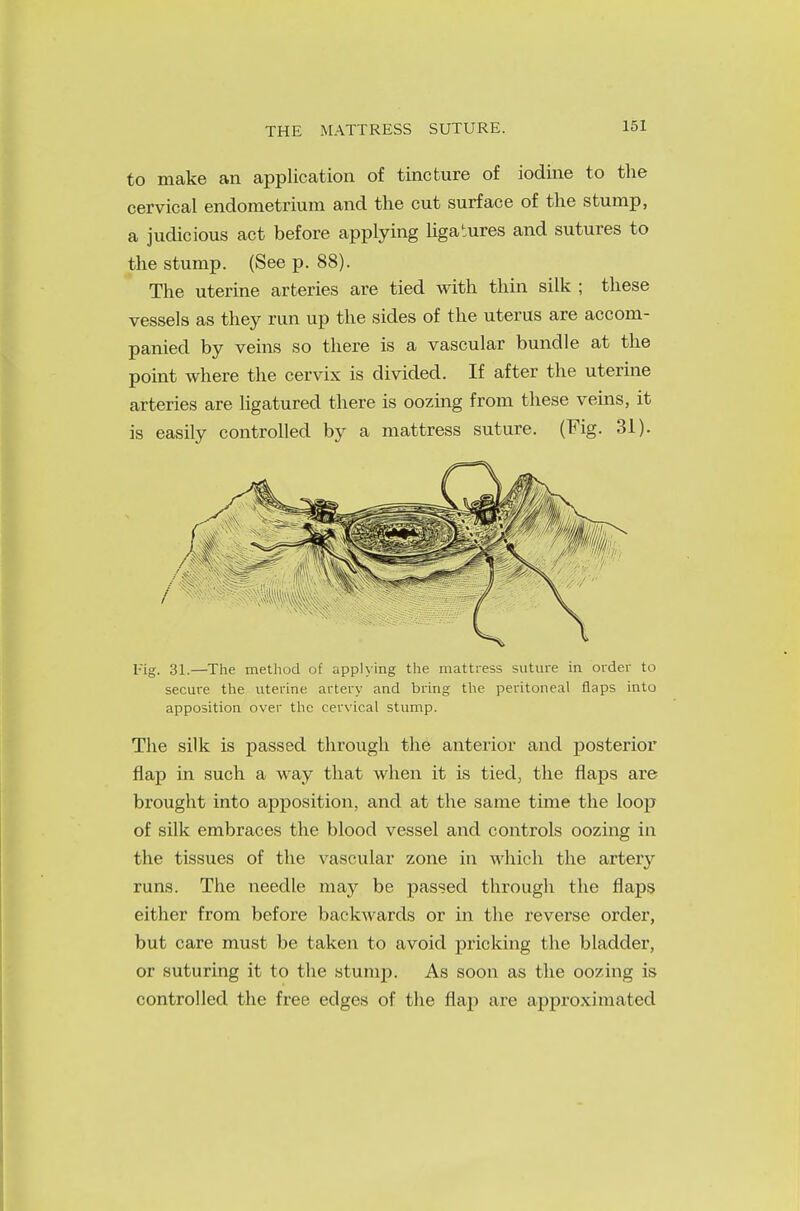 THE MATTRESS SUTURE. to make an application of tincture of iodine to the cervical endometrium and the cut surface of the stump, a judicious act before applying ligatures and sutures to the stump. (See p. 88). The uterine arteries are tied with thin silk ; these vessels as they run up the sides of the uterus are accom- panied by veins so there is a vascular bundle at the point where the cervix is divided. If after the uterine arteries are ligatured there is oozing from these veins, it is easily controlled by a mattress suture. (Fig. 31). Eig. 31.—The method of applying the mattress suture in order to secure the uterine artery and bring the peritoneal flaps into apposition over the cervical stump. The silk is passed through the anterior and posterior flap in such a way that when it is tied, the flaps are brought into apposition, and at the same time the loop of silk embraces the blood vessel and controls oozing in the tissues of the vascular zone in which the artery runs. The needle may be passed through the flaps either from before backwards or in the reverse order, but care must be taken to avoid pricking the bladder, or suturing it to the stump. As soon as the oozing is controlled the free edges of the flap are approximated