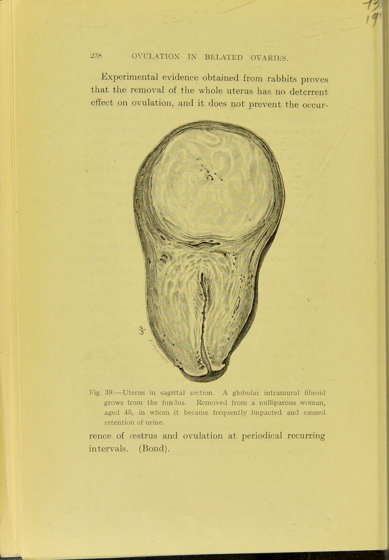 Experimental evidence obtained from rabbits proves that the removal of the whole uterus has no deterrent effect on ovulation, and it does not prevent the occur- Fig. 39.—Uterus in sagittal section. A globular intramural fibroid grows from the fun.lus. Removed from a nulliparous woman, aged 45, in whom it became frequently impacted and caused retention of urine. rence of cestrus and ovulation at periodical recurring intervals. (Bond).