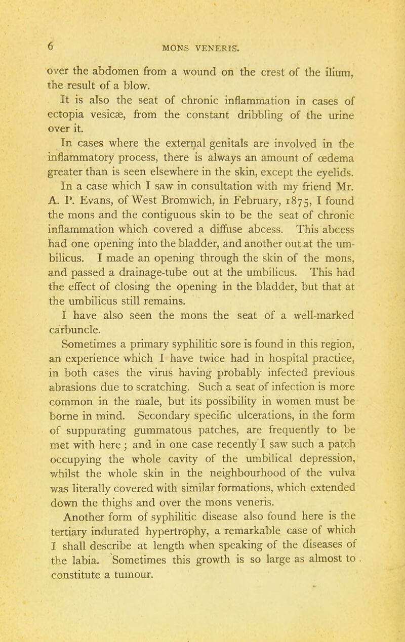 over the abdomen from a wound on the crest of the ilium, the result of a blow. It is also the seat of chronic inflammation in cases of ectopia vesicae, from the constant dribbling of the urine over it. In cases where the external genitals are involved in the inflammatory process, there is always an amount of oedema greater than is seen elsewhere in the skin, except the eyelids. In a case which I saw in consultation with my friend Mr. A. P. Evans, of West Bromwich, in February, 1875, I found the mons and the contiguous skin to be the seat of chronic inflammation which covered a diffuse abcess. This abcess had one opening into the bladder, and another out at the um- bilicus. I made an opening through the skin of the mons, and passed a drainage-tube out at the umbilicus. This had the effect of closing the opening in the bladder, but that at the umbilicus still remains. I have also seen the mons the seat of a well-marked carbuncle. Sometimes a primary syphilitic sore is found in this region, an experience which I have twice had in hospital practice, in both cases the virus having probably infected previous abrasions due to scratching. Such a seat of infection is more common in the male, but its possibility in women must be borne in mind. Secondary specific ulcerations, in the form of suppurating gummatous patches, are frequently to be met with here; and in one case recently I saw such a patch occupying the whole cavity of the umbilical depression, whilst the whole skin in the neighbourhood of the vulva was literally covered with similar formations, which extended down the thighs and over the mons veneris. Another form of syphilitic disease also found here is the tertiary indurated hypertrophy, a remarkable case of which I shall describe at length when speaking of the diseases of the labia. Sometimes this growth is so large as almost to constitute a tumour.