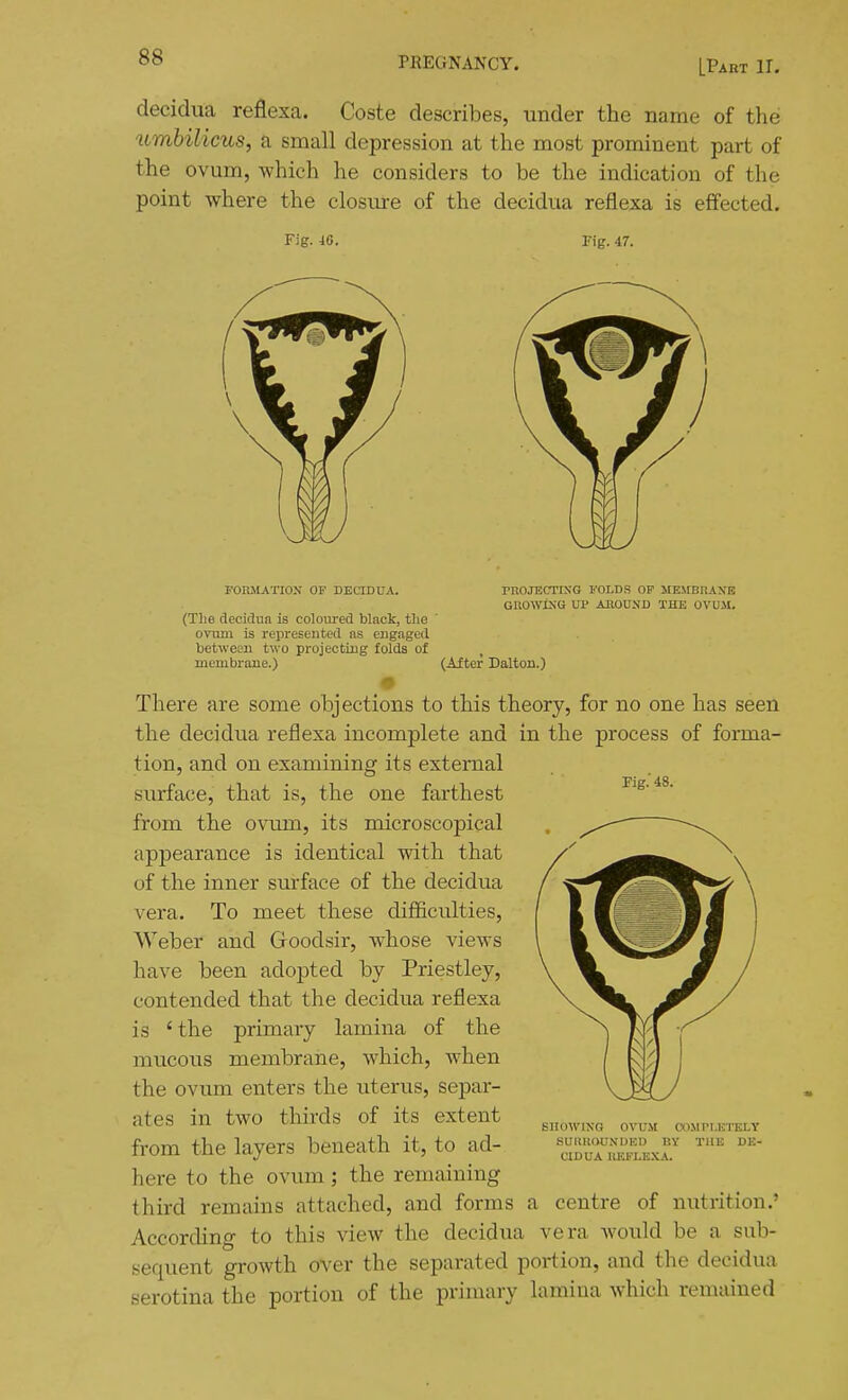 [Part IT. decidua reflexa. Coste describes, under the name of the umbilicus, a small depression at the most prominent part of the ovum, which he considers to be the indication of the point where the closure of the decidua reflexa is effected. Fig. 40. rig. 47. FOnilATION OF DECIDUA. (Tlie deeiclun is coloured black, the ovum is represeuted as engaged between two projecting folds of PROJBCTIXG FOLDS OP MEMBRAXE GnOWlXG UP ABOUND THE OVUM. membrane.) (After Dalton.) Fig. 48. There are some objections to this theory, for no one has seen the decidua reflexa incomplete and in the process of forma- tion, and on examining its external surface, that is, the one farthest from the ovum, its microscopical appearance is identical with that of the inner surface of the decidua vera. To meet these difficulties, Weber and Groodsir, whose views have been adopted by Priestley, contended that the decidua reflexa is ' the primary lamina of the mucous membrane, which, when the ovum enters the iiterus, separ- ates in two thirds of its extent from the layers beneath it, to ad- here to the ovum ; the remaining third remains attached, and forms a centre of nutrition,' According to this view the decidua vera would be a sub- sequent growth over the separated portion, and the decidua serotina the portion of the primary lamina which remained BllOWIXa OVUM COMPI-ETKLY SUimoONDED BY THE DE- CIDUA llEFLEXA.