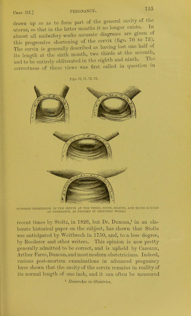 Chap. III.] PREGNANCY. drawn up so as to form part of the general cavity of the uterus, so that in the latter months it no longer exists. In ahnost all midwifery works accm-ate diagrams are given ot this progressive shortening of the cervix (figs. 70 to ^3). The cervix is generaUy described as having lost one halt ot its length at the sixth month, two thirds at the seventh, and to be entirely obliterated in the eighth and mnth. i he correctness of these views was first called in question m Figs. 70, 71, 72, 73. SUPrOSED SnonTEXLVG OF TnE CERVIX AT THE THIRD, SIXTH, EIGHTH, A>D NINTH M0.NTU3 OF I'llEQXANCy, AS riGUIUSD OBSTIiTMC WORKS. recent times by Stoltz, in 1826, but Dr. Duncan,' in an ela- borate historical paper on the subject, has shown that Stoltz was anticipated by Weitbrech in 1750, and, to a less degree, by Roederer and other writers. This opinion is now pretty generally admitted to be correct, and is upheld by Cazeaixx, Arthur Farre, Duncan, and most modern obstetricians. Indeed, various post-mortem examinations in advanced pregnancy have shown that the cavity of the cervix remains in reality of its normal length of one inch, and it can often be measured