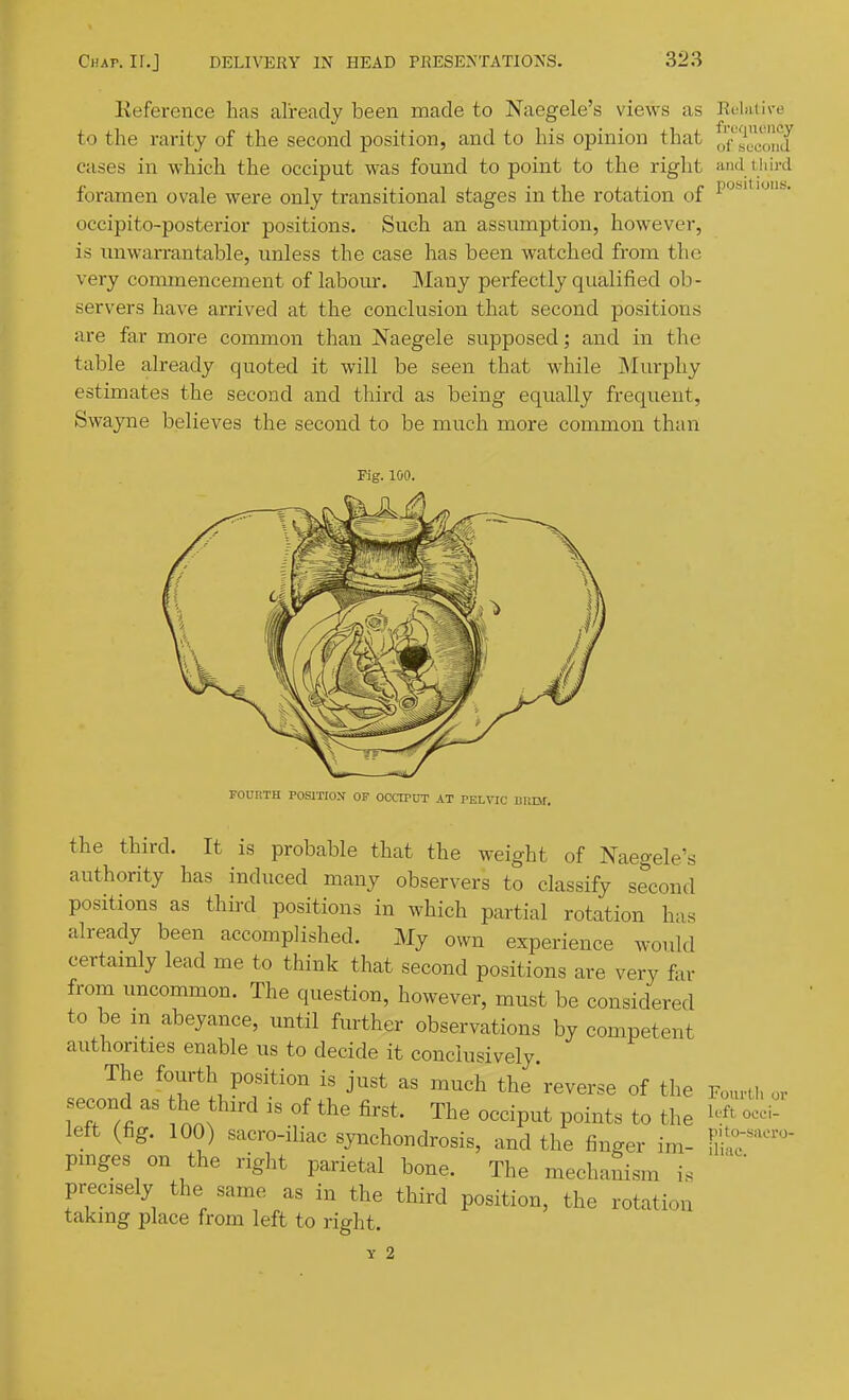 Keference has already been made to Naegele's views as Ri'lfUive to the rarity of the second position, and to his opinion that J/secoiaf cases in which the occiput was found to point to the right and i hird foramen ovale were only transitional stages in the rotation of P''''^'' occipito-posterior positions. Such an assumption, however, is unwarrantable, unless the case has been watched from the very conunencement of labour. Many perfectly qualified ob- servers have arrived at the conclusion that second positions are far more common than Naegele supposed; and in the table already quoted it will be seen that while Murphy estimates the second and third as being equally frequent, Swayne believes the second to be much more common than Pig. 100. FOURTH POSITION OF OCCITUT AT PELVIC UIll the third. It is probable that the weight of Naegele's authority has induced many observers to classify second positions as third positions in which partial rotation has already been accomplished. My own experience would certainly lead me to think that second positions are very far from uncommon. The question, however, must be considered to be m abeyance, until further observations by competent authorities enable us to decide it conclusively. The fourth position is just as much the reverse of the Fourth or second as he third is of the first. The occiput points to the oeci- left (fig. 100) sacro-iliac synchondrosis, and the finger im- fiht''™ pmges on the right parietal bone. The mechaSism is '  precisely the same as in the third position, the rotation taking place from left to right. y 2