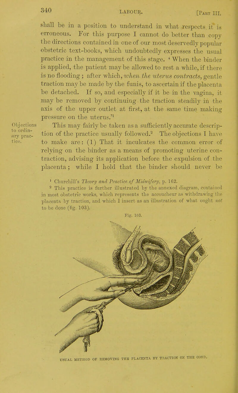 [Part III. Objections to ordin- ary prac- tice. shall be in a position to understand in what respects, it' is erroneous. For this purpose I cannot do better than copy the directions contained in one of our most deservedly popular obstetric text-books, which undoubtedly expresses the usual practice in the management of this stage. ' When the binder is applied, the patient maybe alloM^edto rest a while, if there is no flooding; after which, tuhen the uterus contracts, gentle traction may be made by the funis, to ascertain if the placenta be detached. If so, and especially if it be in the vagina, it may be removed by continuiug the traction steadily in the axis of the upper outlet at first, at the same time making pressure on the uterus.'' This may fairly be taken as a sufficiently accurate descrip- tion of the practice usually followed.^ The objections T have to make are: (1) That it inculcates the common error of relying on the binder as a means of promoting uterine con- traction, advising its application before the expulsion of the placenta; while I hold that the binder should never be ' Clnu'cliill's Thcorj/ and Practice of Midwifery, ^. 162. 2 This practice is further illustrated by the annexed diagi'am, contained in most obstetric works, which represents the accoucheur as withdrawng tlie placenta by traction, and which I insert as an illustration of what ought not to be done (fig. 103). Fig. 103. USUAL METUOD OF nitMOVraO THE PLACKSTA BY TnACTION OX THE COHD.