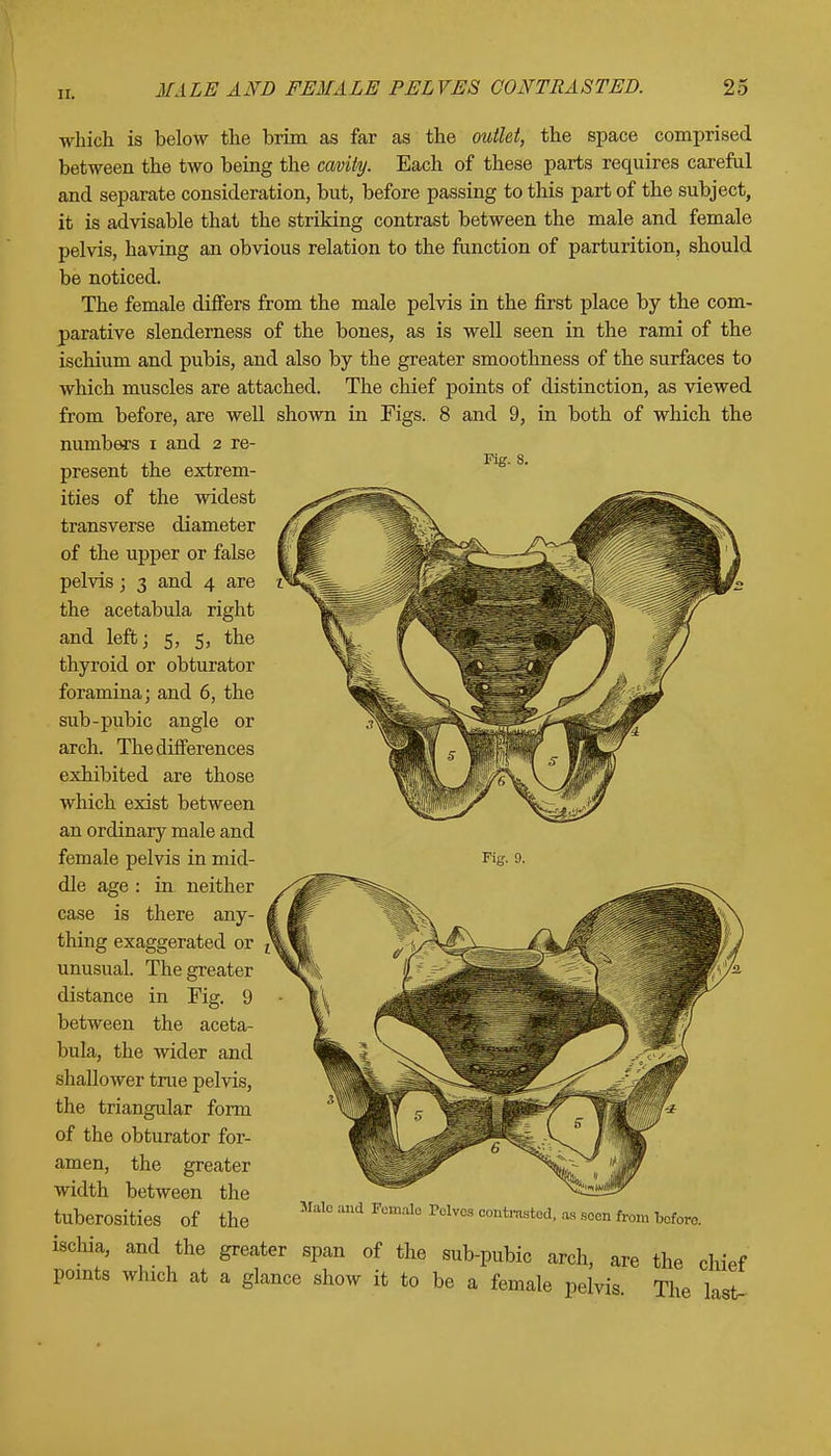 which is below the brim as far as the outlet, the space comprised between the two being the cavity. Each of these parts requires careful and separate consideration, but, before passing to this part of the subject, it is advisable that the striking contrast between the male and female pelvis, having an obvious relation to the function of parturition, should be noticed. The female differs from the male pelvis in the first place by the com- parative slenderness of the bones, as is well seen in the rami of the ischium and pubis, and also by the greater smoothness of the surfaces to which muscles are attached. The chief points of distinction, as viewed from before, are well shown in Figs. 8 and 9, in both of which the numbers i and 2 re- present the extrem- ities of the widest transverse diameter of the upper or false pelvis; 3 and 4 are the acetabula right and left; 5, 5, the thyroid or obturator foramina; and 6, the sub-pubic angle or arch. The differences exhibited are those which exist between an ordinary male and female pelvis in mid- dle age : in neither case is there any- thing exaggerated or unusual. The greater distance in Fig. 9 between the aceta- bula, the wider and shallower true pelvis, the triangular form of the obturator for- amen, the greater width between the tuberosities of the ischia, and the greater span of the sub-pubic arch, points which at a glance show it to be a female pelvis. Fig. 9. Male and Female Pelves contrasted, as seen from before. of the the chief The last-