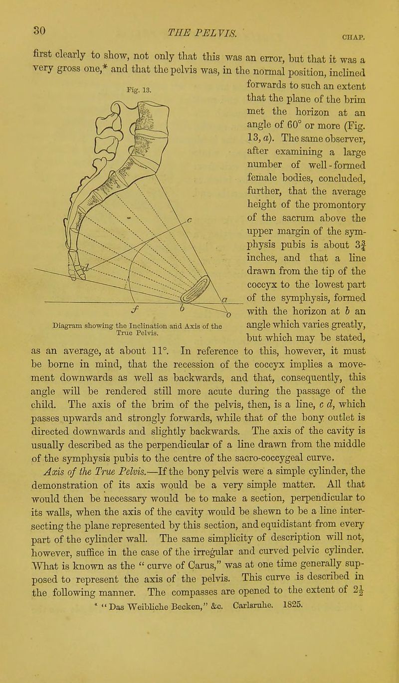 cnAP. first clearly to show, not only that this was an error, hut that it was a very gross one * and that the pelvis was, in the normal position, inclined forwards to such an extent that the plane of the brim met the horizon at an angle of 60° or more (Fig. 13, a). The same observer, after examining a large number of well-formed female bodies, concluded, further, that the average height of the promontory of the sacrum above the upper margin of the sym- physis pubis is about 3| inches, and that a line drawn from the tip of the coccyx to the lowest part of the symphysis, formed J1 6 ~~~--^) with the horizon at b an Diagram showing the Inclination arid Axis of the angle which varies greatly, True Pelvis. may stated, as an average, at about 11°. In reference to this, however, it must be borne in mind, that the recession of the coccyx implies a move- ment downwards as well as backwards, and that, consequently, this angle will be rendered still more acute during the passage of the child. The axis of the brim of the pelvis, then, is a line, c d, which passes upwards and strongly forwards, while that of the bony outlet is directed downwards and slightly backwards. The axis of the cavity is usually described as the perpendicular of a line drawn from the middle of the symphysis pubis to the centre of the sacro-coccygeal curve. Axis of tlie True Pelvis.—If the bony pelvis were a simple cylinder, the demonstration of its axis would be a very simple matter. All that would then be necessary would be to make a section, perpendicular to its walls, when the axis of the cavity would be shewn to be a line inter- secting the plane represented by this section, and equidistant from every part of the cylinder wall. The same simplicity of description will not, however, suffice in the case of the irregular and curved pelvic cylinder. What is known as the curve of Carus, was at one time generally sup- posed to represent the axis of the pelvis. This curve is described in the following manner. The compasses are opened to the extent of 2£ * Das Weibliche Becken, &c. Carlsruhc. 1825. Fig. 13.
